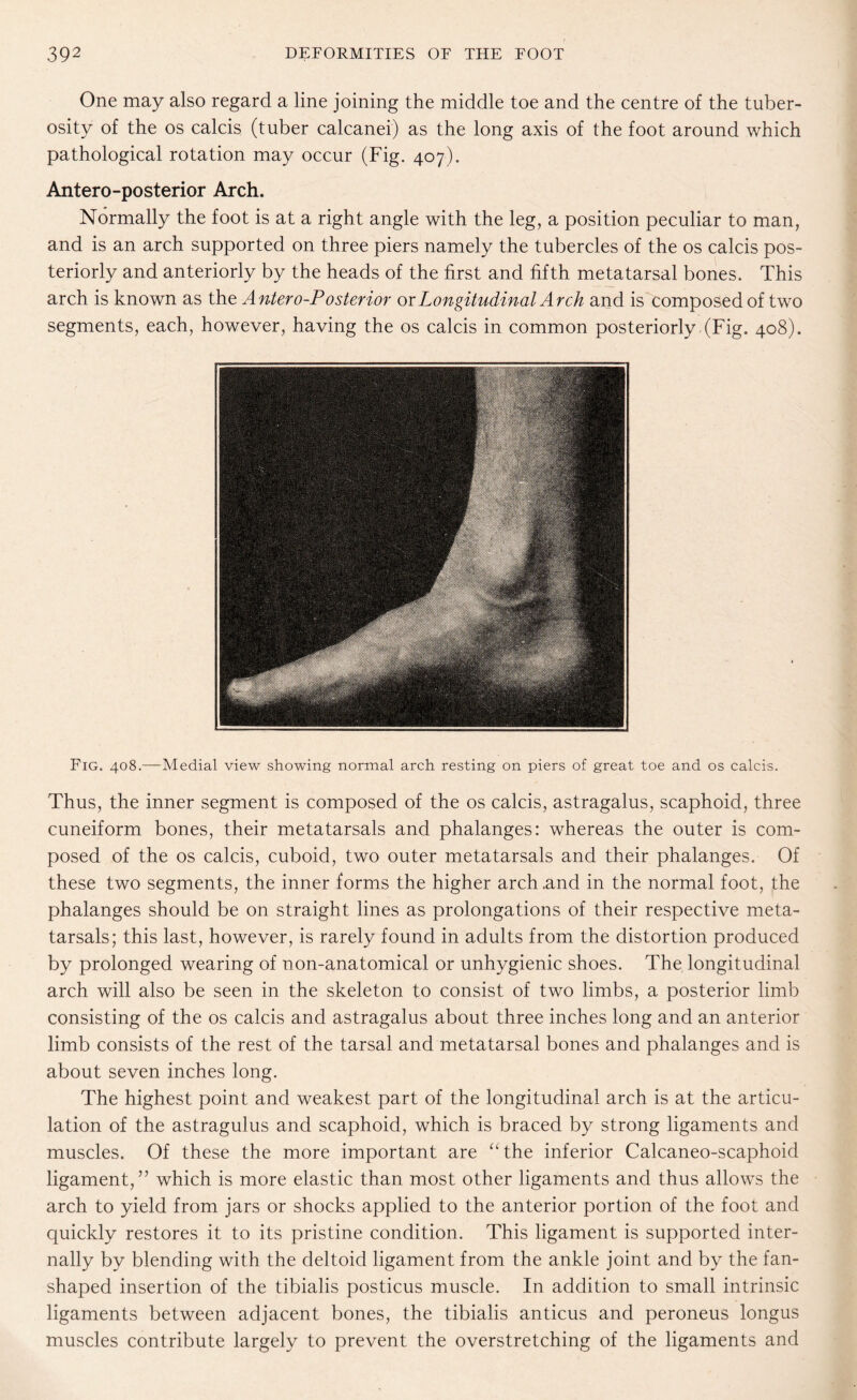 One may also regard a line joining the middle toe and the centre of the tuber¬ osity of the os calcis (tuber calcanei) as the long axis of the foot around which pathological rotation may occur (Fig. 407). Antero-posterior Arch. Normally the foot is at a right angle with the leg, a position peculiar to man, and is an arch supported on three piers namely the tubercles of the os calcis pos¬ teriorly and anteriorly by the heads of the first and fifth metatarsal bones. This arch is known as the Antero-P osterior or Longitudinal Arch and is composed of two segments, each, however, having the os calcis in common posteriorly (Fig. 408). Fig. 408.—Medial view showing normal arch resting on piers of great toe and os calcis. Thus, the inner segment is composed of the os calcis, astragalus, scaphoid, three cuneiform bones, their metatarsals and phalanges: whereas the outer is com¬ posed of the os calcis, cuboid, two outer metatarsals and their phalanges. Of these two segments, the inner forms the higher arch .and in the normal foot, the phalanges should be on straight lines as prolongations of their respective meta¬ tarsals; this last, however, is rarely found in adults from the distortion produced by prolonged wearing of non-anatomical or unhygienic shoes. The longitudinal arch will also be seen in the skeleton to consist of two limbs, a posterior limb consisting of the os calcis and astragalus about three inches long and an anterior limb consists of the rest of the tarsal and metatarsal bones and phalanges and is about seven inches long. The highest point and weakest part of the longitudinal arch is at the articu¬ lation of the astragulus and scaphoid, which is braced by strong ligaments and muscles. Of these the more important are “the inferior Calcaneo-scaphoid ligament,” which is more elastic than most other ligaments and thus allows the arch to yield from jars or shocks applied to the anterior portion of the foot and quickly restores it to its pristine condition. This ligament is supported inter¬ nally by blending with the deltoid ligament from the ankle joint and by the fan¬ shaped insertion of the tibialis posticus muscle. In addition to small intrinsic ligaments between adjacent bones, the tibialis anticus and peroneus longus muscles contribute largely to prevent the overstretching of the ligaments and