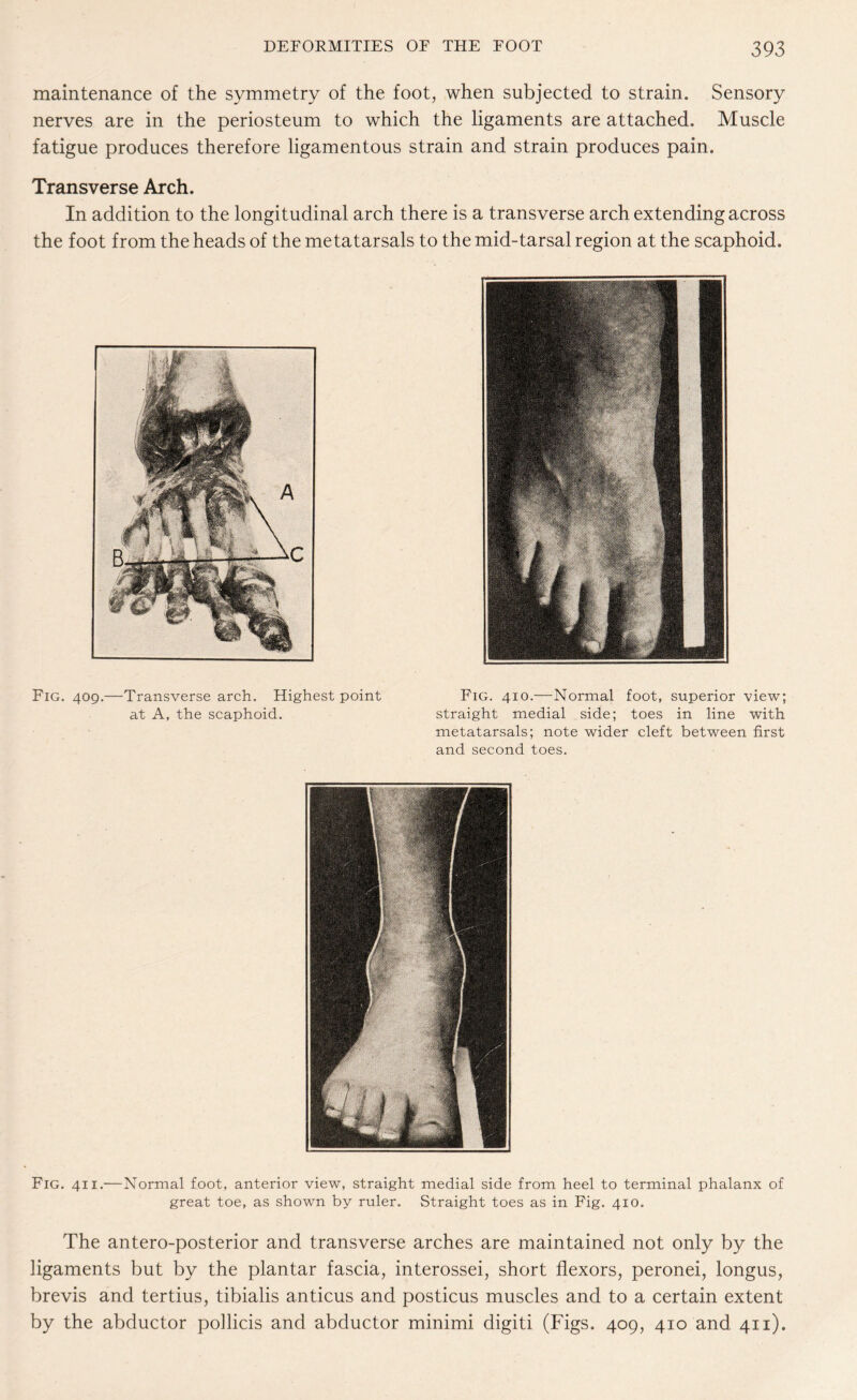 maintenance of the symmetry of the foot, when subjected to strain. Sensory nerves are in the periosteum to which the ligaments are attached. Muscle fatigue produces therefore ligamentous strain and strain produces pain. Transverse Arch. In addition to the longitudinal arch there is a transverse arch extending across the foot from the heads of the metatarsals to the mid-tarsal region at the scaphoid. Fig. 409.—Transverse arch. Highest point at A, the scaphoid. Fig. 410.—Normal foot, superior view; straight medial side; toes in line with metatarsals; note wider cleft between first and second toes. Fig. 411.—Normal foot, anterior view, straight medial side from heel to terminal phalanx of great toe, as shown by ruler. Straight toes as in Fig. 410. The antero-posterior and transverse arches are maintained not only by the ligaments but by the plantar fascia, interossei, short flexors, peronei, longus, brevis and tertius, tibialis anticus and posticus muscles and to a certain extent by the abductor pohicis and abductor minimi digiti (Figs. 409, 410 and 411).