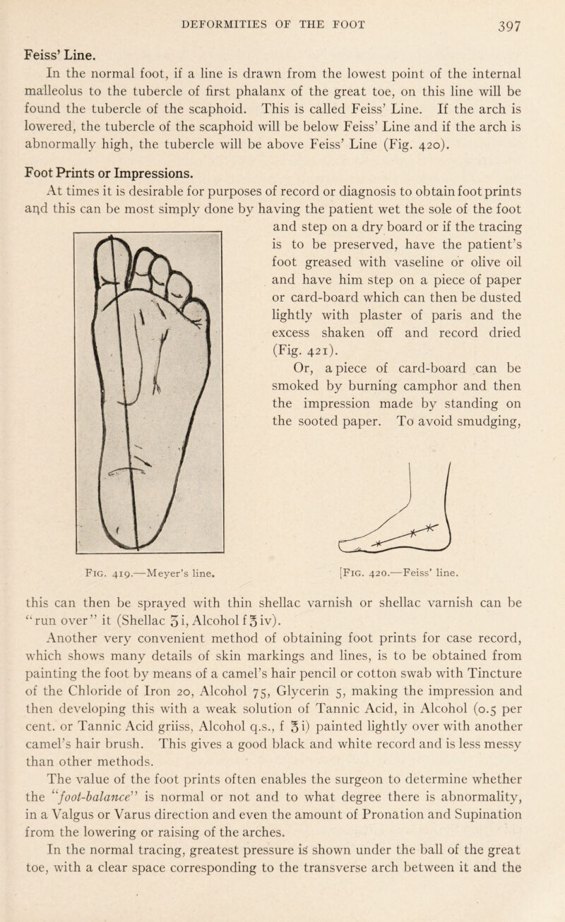 Fetes’ Line. In the normal foot, if a line is drawn from the lowest point of the internal malleolus to the tubercle of first phalanx of the great toe, on this line will be found the tubercle of the scaphoid. This is called Fetes’ Line. If the arch is lowered, the tubercle of the scaphoid will be below Feiss’ Line and if the arch is abnormally high, the tubercle will be above Feiss’ Line (Fig. 420). Foot Prints or Impressions. At times it is desirable for purposes of record or diagnosis to obtain foot prints ar}d this can be most simply done by having the patient wet the sole of the foot and step on a dry board or if the tracing is to be preserved, have the patient’s foot greased with vaseline or olive oil and have him step on a piece of paper or card-board which can then be dusted lightly with plaster of paris and the excess shaken off and record dried (Fig. 421). Or, a piece of card-board can be smoked by burning camphor and then the impression made by standing on the sooted paper. To avoid smudging, Fig. 419.—Meyer’s line. this can then be sprayed with thin shellac varnish or shellac varnish can be “run over” it (Shellac 3b Alcoholf3iv). Another very convenient method of obtaining foot prints for case record, which shows many details of skin markings and lines, is to be obtained from painting the foot by means of a camel’s hair pencil or cotton swab with Tincture of the Chloride of Iron 20, Alcohol 75, Glycerin 5, making the impression and then developing this with a weak solution of Tannic Acid, in Alcohol (0.5 per cent, or Tannic Acid griiss, Alcohol q.s., f 5i) painted lightly over with another camel’s hair brush. This gives a good black and white record and is less messy than other methods. The value of the foot prints often enables the surgeon to determine whether the “foot-balance is normal or not and to what degree there is abnormality, in a Valgus or Varus direction and even the amount of Pronation and Supination from the lowering or raising of the arches. In the normal tracing, greatest pressure is shown under the ball of the great toe, with a clear space corresponding to the transverse arch between it and the