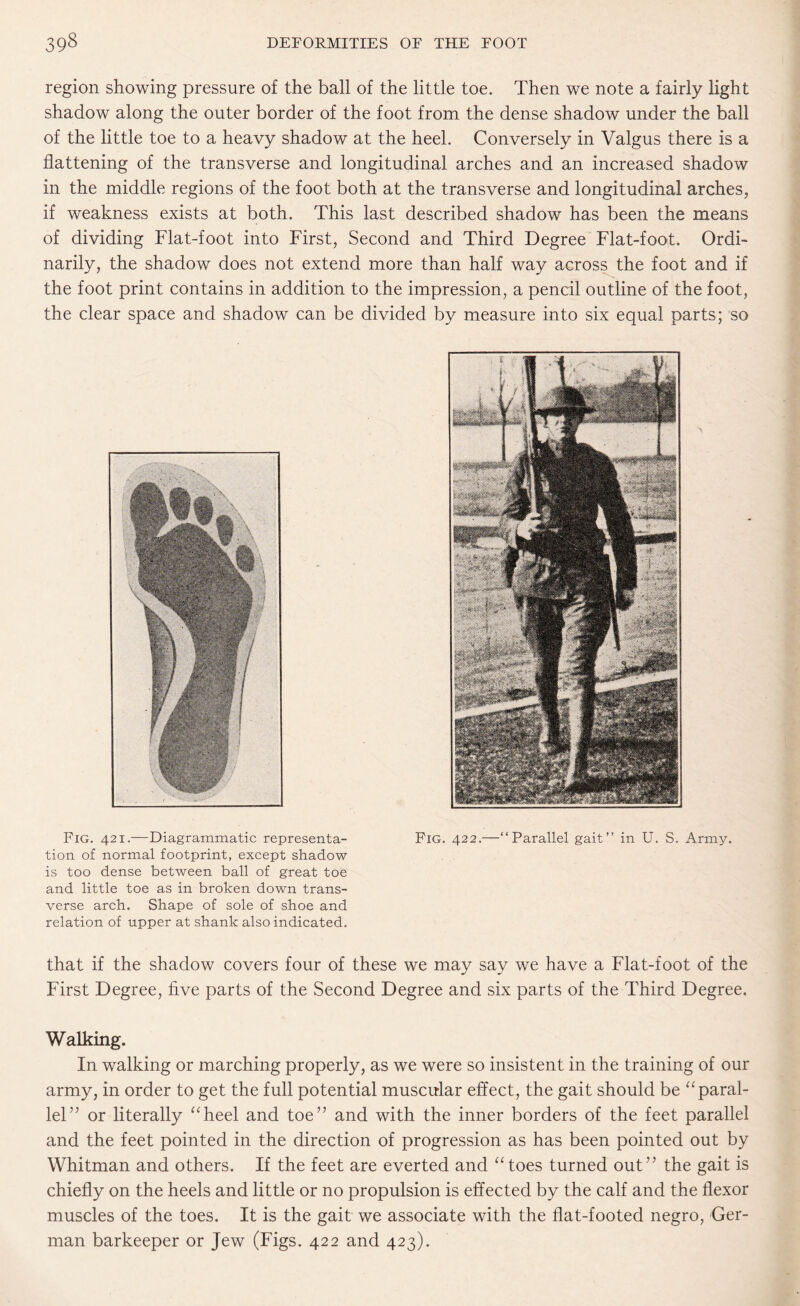 region showing pressure of the ball of the little toe. Then we note a fairly light shadow along the outer border of the foot from the dense shadow under the ball of the little toe to a heavy shadow at the heel. Conversely in Valgus there is a flattening of the transverse and longitudinal arches and an increased shadow in the middle regions of the foot both at the transverse and longitudinal arches, if weakness exists at both. This last described shadow has been the means of dividing Flat-foot into First, Second and Third Degree Flat-foot. Ordi¬ narily, the shadow does not extend more than half way across the foot and if the foot print contains in addition to the impression, a pencil outline of the foot, the clear space and shadow can be divided by measure into six equal parts; so Fig. 421.—Diagrammatic representa- Fig. 422.—“Parallel gait’’ in U. S. Army, tion of normal footprint, except shadow is too dense between ball of great toe and little toe as in broken down trans¬ verse arch. Shape of sole of shoe and relation of upper at shank also indicated. that if the shadow covers four of these we may say we have a Flat-foot of the First Degree, five parts of the Second Degree and six parts of the Third Degree. Walking. In walking or marching properly, as we were so insistent in the training of our army, in order to get the full potential muscular effect, the gait should be “ paral¬ lel” or literally “heel and toe” and with the inner borders of the feet parallel and the feet pointed in the direction of progression as has been pointed out by Whitman and others. If the feet are everted and “toes turned out” the gait is chiefly on the heels and little or no propulsion is effected by the calf and the flexor muscles of the toes. It is the gait we associate with the flat-footed negro, Ger¬ man barkeeper or Jew (Figs. 422 and 423).