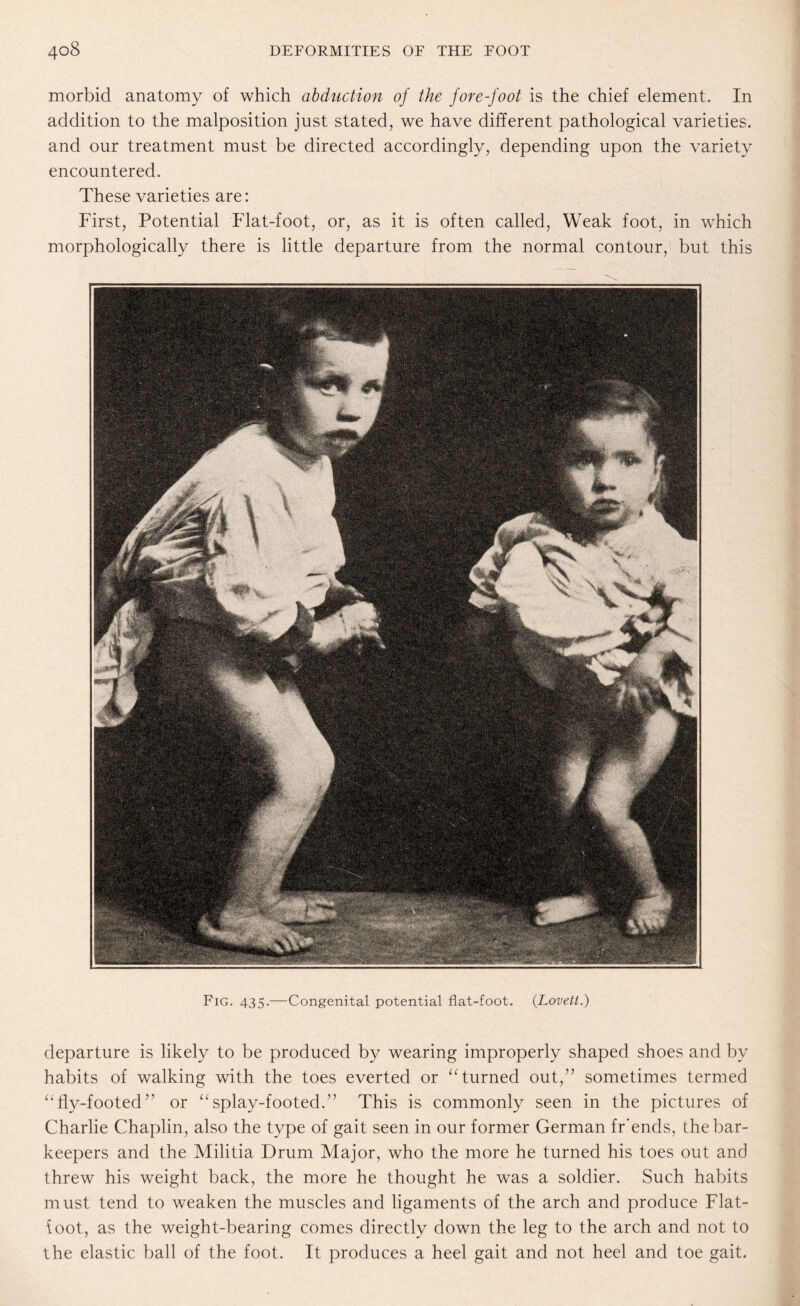 morbid anatomy of which abduction of the fore-foot is the chief element. In addition to the malposition just stated, we have different pathological varieties, and our treatment must be directed accordingly, depending upon the variety encountered. These varieties are: First, Potential Flat-foot, or, as it is often called, Weak foot, in which morphologically there is little departure from the normal contour, but this Fig. 435.—Congenital potential flat-foot. {Lovett.) departure is likely to be produced by wearing improperly shaped shoes and by habits of walking with the toes everted or “ turned out,” sometimes termed “fly-footed” or “splay-footed.” This is commonly seen in the pictures of Charlie Chaplin, also the type of gait seen in our former German fr'ends, the bar¬ keepers and the Militia Drum Major, who the more he turned his toes out and threw his weight back, the more he thought he was a soldier. Such habits must tend to weaken the muscles and ligaments of the arch and produce Flat- ioot, as the weight-bearing comes directly down the leg to the arch and not to the elastic ball of the foot. It produces a heel gait and not heel and toe gait.