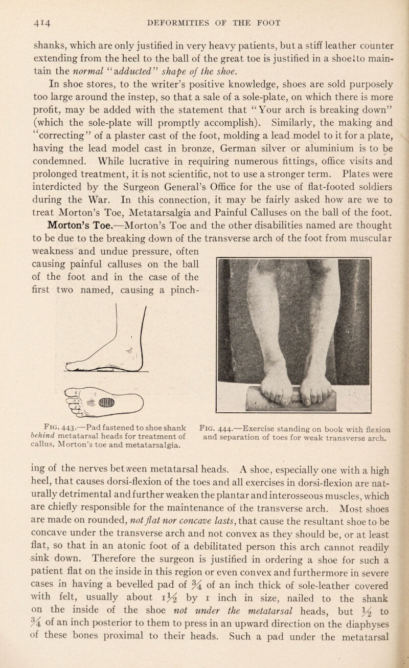 shanks, which are only justified in very heavy patients, but a stiff leather counter extending from the heel to the ball of the great toe is justified in a shoe! to main¬ tain the normal “adducted” shape of the shoe. In shoe stores, to the writer’s positive knowledge, shoes are sold purposely too large around the instep, so that a sale of a sole-plate, on which there is more profit, may be added with the statement that “Your arch is breaking down” (which the sole-plate will promptly accomplish). Similarly, the making and *‘correcting” of a plaster cast of the foot, molding a lead model to it for a plate, having the lead model cast in bronze, German silver or aluminium is to be condemned. While lucrative in requiring numerous fittings, office visits and prolonged treatment, it is not scientific, not to use a stronger term. Plates were interdicted by the Surgeon General’s Office for the use of flat-footed soldiers during the War. In this connection, it may be fairly asked how are we to treat Morton’s Toe, Metatarsalgia and Painful Calluses on the ball of the foot. Morton’s Toe.—Morton’s Toe and the other disabilities named are thought to be due to the breaking down of the transverse arch of the foot from muscular weakness and undue pressure, often causing painful calluses on the ball of the foot and in the case of the first two named, causing a pinch- Fig. 443.—Pad fastened to shoe shank Fig. 444.—Exercise standing on book with flexion behind metatarsal heads for treatment of and separation of toes for weak transverse arch, callus, Morton’s toe and metatarsalgia. ing of the nerves between metatarsal heads. A shoe, especially one with a high heel, that causes dorsi-flexion of the toes and all exercises in dorsi-flexion are nat¬ urally detrimental and further weaken the plantar and interosseous muscles, which are chiefly responsible for the maintenance of the transverse arch. Most shoes are made on rounded, not flat nor concave lasts, that cause the resultant shoe to be concave under the transverse arch and not convex as they should be, or at least flat, so that in an atonic foot of a debilitated person this arch cannot readily sink down. Therefore the surgeon is justified in ordering a shoe for such a patient flat on the inside in this region or even convex and furthermore in severe cases in having a bevelled pad of % of an inch thick of sole-leather covered with felt, usually about 1^2 by 1 inch in size, nailed to the shank on the inside of the shoe not under the metatarsal heads, but 3d2 to M of an inch posterior to them to press in an upward direction on the diaphyses of these bones proximal to their heads. Such a pad under the metatarsal