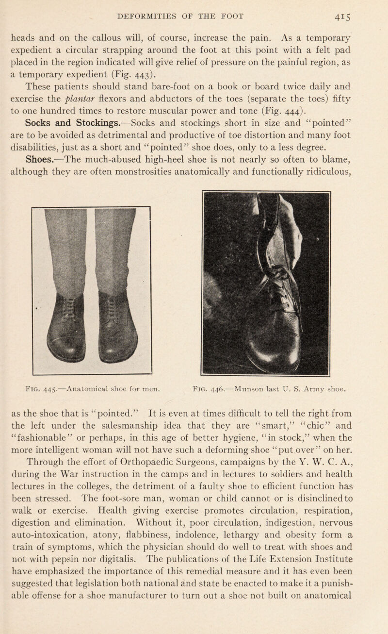 heads and on the callous will, of course, increase the pain. As a temporary expedient a circular strapping around the foot at this point with a felt pad placed in the region indicated will give relief of pressure on the painful region, as a temporary expedient (Fig. 443). These patients should stand bare-foot on a book or board twice daily and exercise the plantar flexors and abductors of the toes (separate the toes) fifty to one hundred times to restore muscular power and tone (Fig. 444). Socks and Stockings.—Socks and stockings short in size and “pointed” are to be avoided as detrimental and productive of toe distortion and many foot disabilities, just as a short and “pointed” shoe does, only to a less degree. Shoes.—The much-abused high-heel shoe is not nearly so often to blame, although they are often monstrosities anatomically and functionally ridiculous, Fig. 445.—Anatomical shoe for men. Fig. 446.—Munson last U. S. Army shoe. as the shoe that is “pointed.” It is even at times difficult to tell the right from the left under the salesmanship idea that they are “smart,” “chic” and “fashionable” or perhaps, in this age of better hygiene, “in stock,” when the more intelligent woman will not have such a deforming shoe “put over” on her. Through the effort of Orthopaedic Surgeons, campaigns by the Y. W. C. A., during the War instruction in the camps and in lectures to soldiers and health lectures in the colleges, the detriment of a faulty shoe to efficient function has been stressed. The foot-sore man, woman or child cannot or is disinclined to walk or exercise. Health giving exercise promotes circulation, respiration, digestion and elimination. Without it, poor circulation, indigestion, nervous auto-intoxication, atony, flabbiness, indolence, lethargy and obesity form a train of symptoms, which the physician should do well to treat with shoes and not with pepsin nor digitalis. The publications of the Life Extension Institute have emphasized the importance of this remedial measure and it has even been suggested that legislation both national and state be enacted to make it a punish¬ able offense for a shoe manufacturer to turn out a shoe not built on anatomical