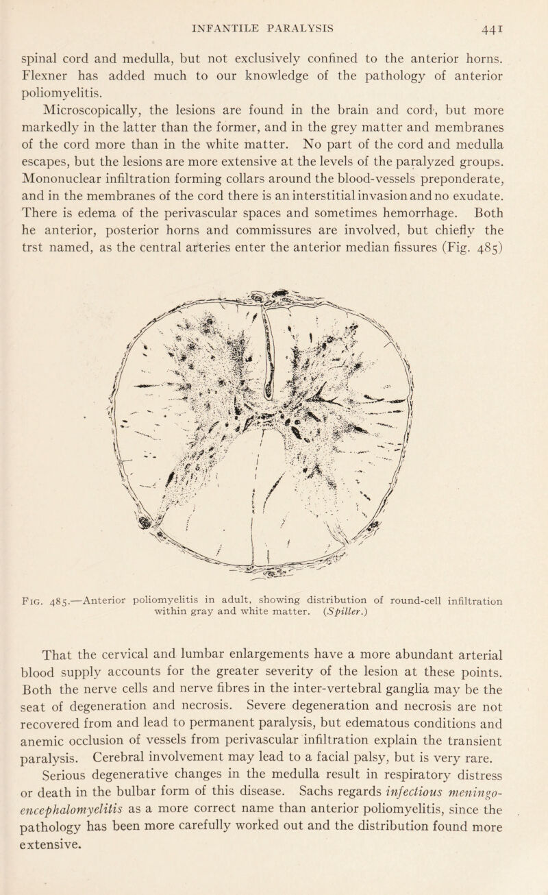 spinal cord and medulla, but not exclusively confined to the anterior horns. Flexner has added much to our knowledge of the pathology of anterior poliomyelitis. Microscopically, the lesions are found in the brain and cord', but more markedly in the latter than the former, and in the grey matter and membranes of the cord more than in the white matter. No part of the cord and medulla escapes, but the lesions are more extensive at the levels of the paralyzed groups. Mononuclear infiltration forming collars around the blood-vessels preponderate, and in the membranes of the cord there is an interstitial invasion and no exudate. There is edema of the perivascular spaces and sometimes hemorrhage. Both he anterior, posterior horns and commissures are involved, but chiefly the trst named, as the central arteries enter the anterior median fissures (Fig. 485) Fig. 485.—Anterior poliomyelitis in adult, showing distribution of round-cell infiltration within gray and white matter. (Spiller.) That the cervical and lumbar enlargements have a more abundant arterial blood supply accounts for the greater severity of the lesion at these points. Both the nerve cells and nerve fibres in the inter-vertebral ganglia may be the seat of degeneration and necrosis. Severe degeneration and necrosis are not recovered from and lead to permanent paralysis, but edematous conditions and anemic occlusion of vessels from perivascular infiltration explain the transient paralysis. Cerebral involvement may lead to a facial palsy, but is very rare. Serious degenerative changes in the medulla result in respiratory distress or death in the bulbar form of this disease. Sachs regards infectious meningo- encephalomyelitis as a more correct name than anterior poliomyelitis, since the pathology has been more carefully worked out and the distribution found more extensive.