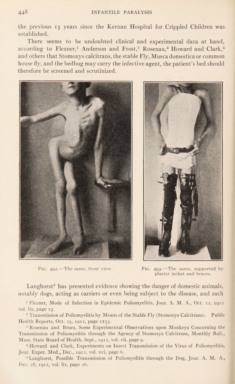 the previous 15 years since the Kernan Hospital for Crippled Children was established. There seems to be undoubted clinical and experimental data at hand, according to Flexner,1 Anderson and Frost,2 Rosenau,3 Howard and Clark,4 and others that Stomoxys calcitrans, the stable Fly, Muscadomesticaor common house fly, and the bedbug may carry the infective agent, the patient’s bed should therefore be screened and scrutinized. Fig. 492.—The same, front view. Fig. 493.—The same, supported by plaster jacket and braces. Langhorst5 has presented evidence showing the danger of domestic animals, notably dogs, acting as carriers or even being subject to the disease, and such 1 Flexner, Mode of Infection in Epidemic Poliomyelitis, Jour. A. M. A., Oct. 12, 1912 vol. lix, page 15. 2 Transmission of Poliomyelitis by Means of the Stable Fly (Stomoxys Calcitrans). Public Health Reports, Oct. 25, 1912, page 1733. 3 Rosenau and Brues, Some Experimental Observations upon Monkeys Concerning the Transmission of Poliomyelitis through the Agency of Stomoxys Calcitrans, Monthly Bull., Mass. State Board of Health, Sept., 1912, vol. vii, page 9. 4 Howard and Clark, Experiments on Insect Transmission of the Virus of Poliomyelitis, Jour. Exper. Med., Dec., 1912, vol. xvi, page 6. 5 Langhorst, Possible Transmission of Poliomyelitis through the Dog, Jour. A. M. A., Dec. 28, 1912, vol. lix, page 26.