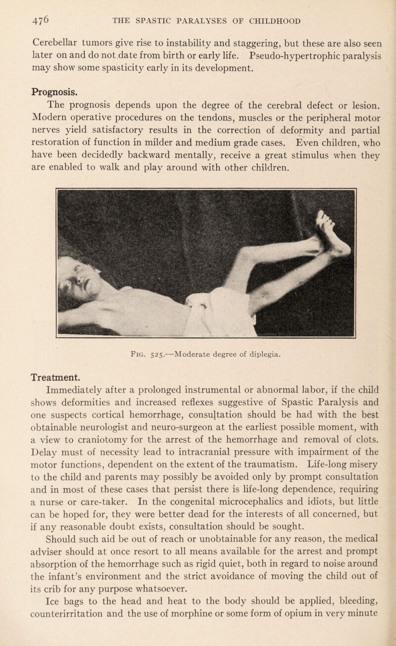 Cerebellar tumors give rise to instability and staggering, but these are also seen later on and do not.date from birth or early life. Pseudo-hypertrophic paralysis may show some spasticity early in its development. Prognosis. The prognosis depends upon the degree of the cerebral defect or lesion. Modern operative procedures on the tendons, muscles or the peripheral motor nerves yield satisfactory results in the correction of deformity and partial restoration of function in milder and medium grade cases. Even children, who have been decidedly backward mentally, receive a great stimulus when they are enabled to walk and play around with other children. Fig. 525.—Moderate degree of diplegia. Treatment. Immediately after a prolonged instrumental or abnormal labor, if the child shows deformities and increased reflexes suggestive of Spastic Paralysis and one suspects cortical hemorrhage, consultation should be had with the best obtainable neurologist and neuro-surgeon at the earliest possible moment, with a view to craniotomy for the arrest of the hemorrhage and removal of clots. Delay must of necessity lead to intracranial pressure with impairment of the motor functions, dependent on the extent of the traumatism. Life-long misery to the child and parents may possibly be avoided only by prompt consultation and in most of these cases that persist there is life-long dependence, requiring a nurse or care-taker. In the congenital microcephalies and idiots, but little can be hoped for, they were better dead for the interests of all concerned, but if any reasonable doubt exists, consultation should be sought. Should such aid be out of reach or unobtainable for any reason, the medical adviser should at once resort to all means available for the arrest and prompt absorption of the hemorrhage such as rigid quiet, both in regard to noise around the infant’s environment and the strict avoidance of moving the child out of its crib for any purpose whatsoever. Ice bags to the head and heat to the body should be applied, bleeding, counterirritation and the use of morphine or some form of opium in very minute