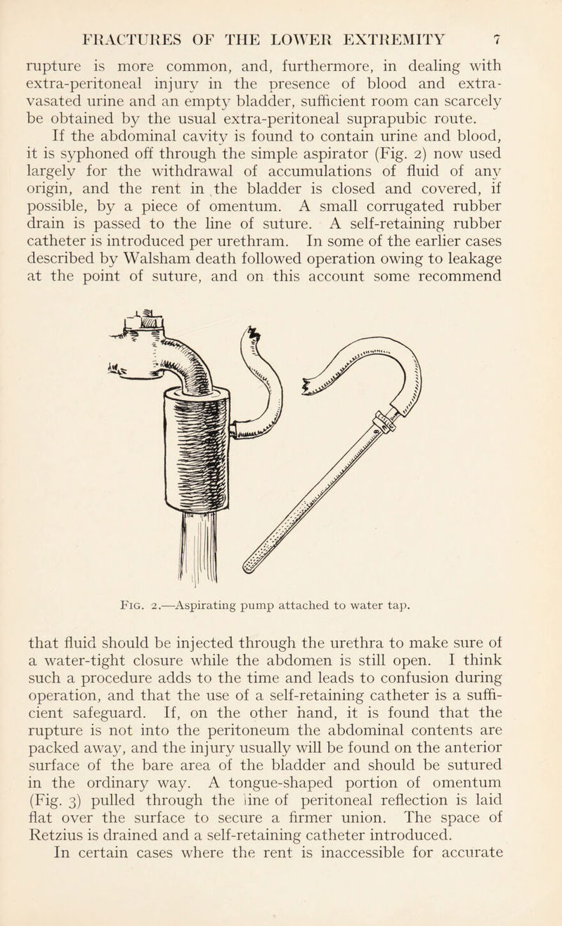 rupture is more common, and, furthermore, in dealing with extra-peritoneal injury in the presence of blood and extra- vasated urine and an empty bladder, sufficient room can scarcely be obtained by the usual extra-peritoneal suprapubic route. If the abdominal cavity is found to contain urine and blood, it is syphoned off through the simple aspirator (Fig. 2) now used largely for the withdrawal of accumulations of fluid of any origin, and the rent in the bladder is closed and covered, if possible, by a piece of omentum. A small corrugated rubber drain is passed to the line of suture. A self-retaining rubber catheter is introduced per urethram. In some of the earlier cases described by Walsham death followed operation owing to leakage at the point of suture, and on this account some recommend P ig. 2.—Aspirating pump attached to water tap. that fluid should be injected through the urethra to make sure of a water-tight closure while the abdomen is still open. I think such a procedure adds to the time and leads to confusion during operation, and that the use of a self-retaining catheter is a suffi¬ cient safeguard. If, on the other hand, it is found that the rupture is not into the peritoneum the abdominal contents are packed away, and the injury usually will be found on the anterior surface of the bare area of the bladder and should be sutured in the ordinary way. A tongue-shaped portion of omentum (Fig. 3) pulled through the line of peritoneal reflection is laid flat over the surface to secure a. firmer union. The space of Retzius is drained and a self-retaining catheter introduced. In certain cases where the rent is inaccessible for accurate