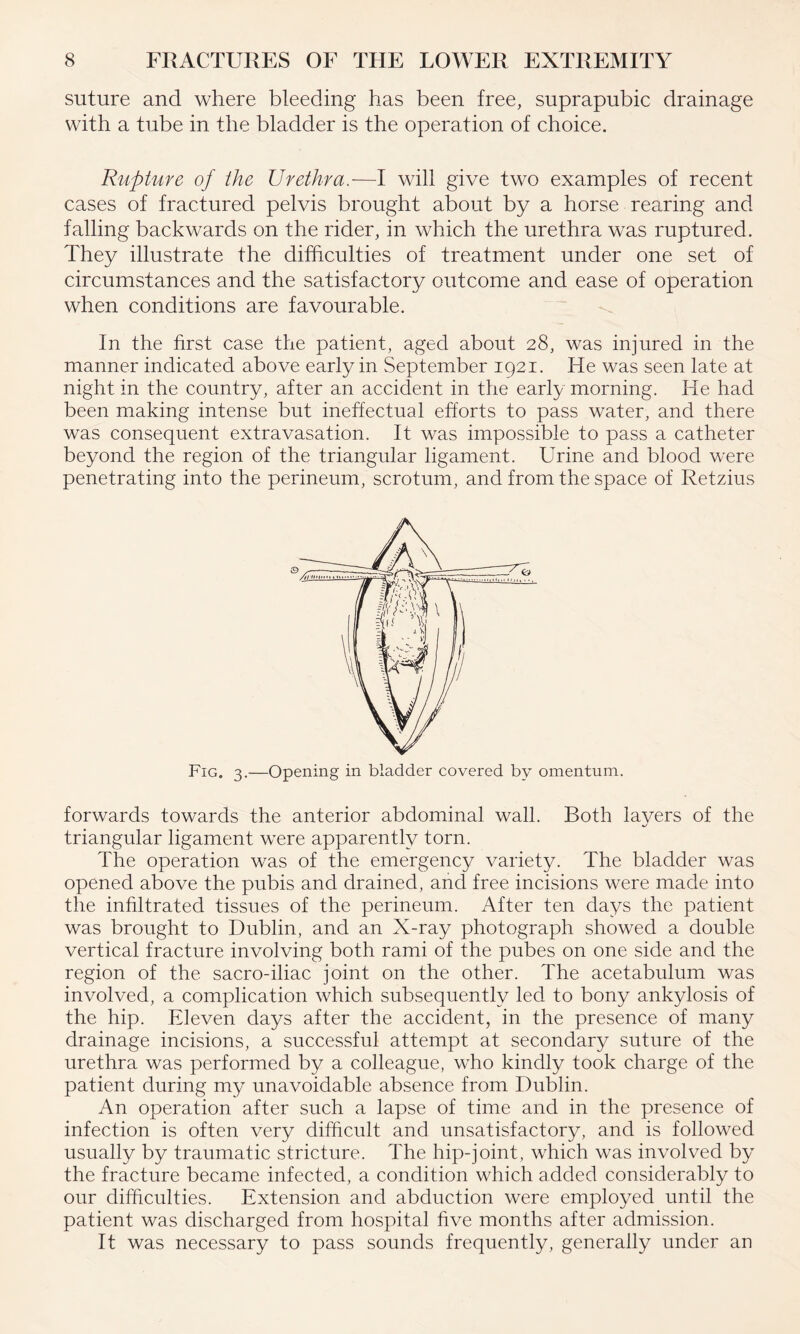 suture and where bleeding has been free, suprapubic drainage with a tube in the bladder is the operation of choice. Rupture of the Urethra.—I will give two examples of recent cases of fractured pelvis brought about by a horse rearing and falling backwards on the rider, in which the urethra was ruptured. They illustrate the difficulties of treatment under one set of circumstances and the satisfactory outcome and ease of operation when conditions are favourable. In the first case the patient, aged about 28, was injured in the manner indicated above early in September 1921. He was seen late at night in the country, after an accident in the early morning. He had been making intense but ineffectual efforts to pass water, and there was consequent extravasation. It was impossible to pass a catheter beyond the region of the triangular ligament. Urine and blood were penetrating into the perineum, scrotum, and from the space of Retzius Fig. 3.—Opening in bladder covered by omentum. forwards towards the anterior abdominal wall. Both layers of the triangular ligament were apparently torn. The operation was of the emergency variety. The bladder was opened above the pubis and drained, and free incisions were made into the infiltrated tissues of the perineum. After ten days the patient was brought to Dublin, and an X-ray photograph showed a double vertical fracture involving both rami of the pubes on one side and the region of the sacro-iliac joint on the other. The acetabulum was involved, a complication which subsequently led to bony ankylosis of the hip. Eleven days after the accident, in the presence of many drainage incisions, a successful attempt at secondary suture of the urethra was performed by a colleague, who kindly took charge of the patient during my unavoidable absence from Dublin. An operation after such a lapse of time and in the presence of infection is often very difficult and unsatisfactory, and is followed usually by traumatic stricture. The hip-joint, which was involved by the fracture became infected, a condition which added considerably to our difficulties. Extension and abduction were employed until the patient was discharged from hospital five months after admission. It was necessary to pass sounds frequently, generally under an