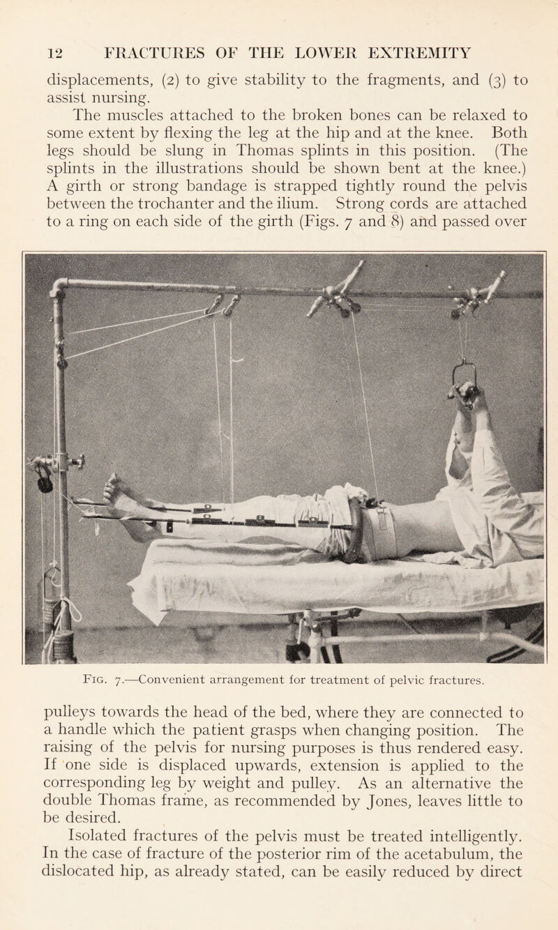 displacements, (2) to give stability to the fragments, and (3) to assist nursing. The muscles attached to the broken bones can be relaxed to some extent by flexing the leg at the hip and at the knee. Both legs should be slung in Thomas splints in this position. (The splints in the illustrations should be shown bent at the knee.) A girth or strong bandage is strapped tightly round the pelvis between the trochanter and the ilium. Strong cords are attached to a ring on each side of the girth (Figs. 7 and 8) and passed over Fig. 7.—Convenient arrangement for treatment of pelvic fractures. pulleys towards the head of the bed, where they are connected to a handle which the patient grasps when changing position. The raising of the pelvis for nursing purposes is thus rendered easy. If one side is displaced upwards, extension is applied to the corresponding leg by weight and pulley. As an alternative the double Thomas frame, as recommended by Jones, leaves little to be desired. Isolated fractures of the pelvis must be treated intelligently. In the case of fracture of the posterior rim of the acetabulum, the dislocated hip, as already stated, can be easily reduced by direct