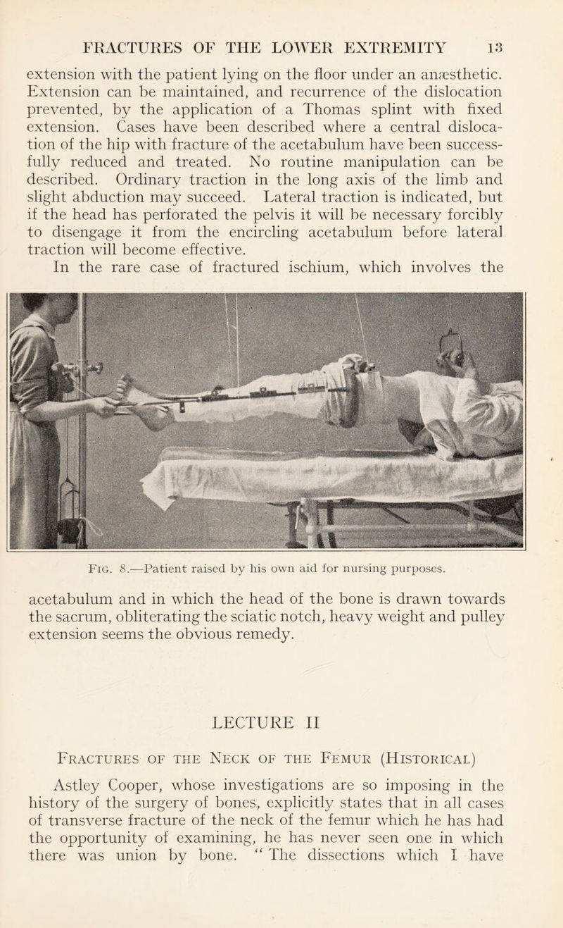 extension with the patient lying on the floor under an anaesthetic. Extension can be maintained, and recurrence of the dislocation prevented, by the application of a Thomas splint with fixed extension. Cases have been described where a central disloca¬ tion of the hip with fracture of the acetabulum have been success¬ fully reduced and treated. No routine manipulation can be described. Ordinary traction in the long axis of the limb and slight abduction may succeed. Lateral traction is indicated, but if the head has perforated the pelvis it will be necessary forcibly to disengage it from the encircling acetabulum before lateral traction will become effective. In the rare case of fractured ischium, which involves the Fig. 8.—Patient raised by his own aid for nursing purposes. acetabulum and in which the head of the bone is drawn towards the sacrum, obliterating the sciatic notch, heavy weight and pulley extension seems the obvious remedy. LECTURE II Fractures of the Neck of the Femur (Historical) Astley Cooper, whose investigations are so imposing in the history of the surgery of bones, explicitly states that in all cases of transverse fracture of the neck of the femur which he has had the opportunity of examining, he has never seen one in which there was union by bone. “ The dissections which I have