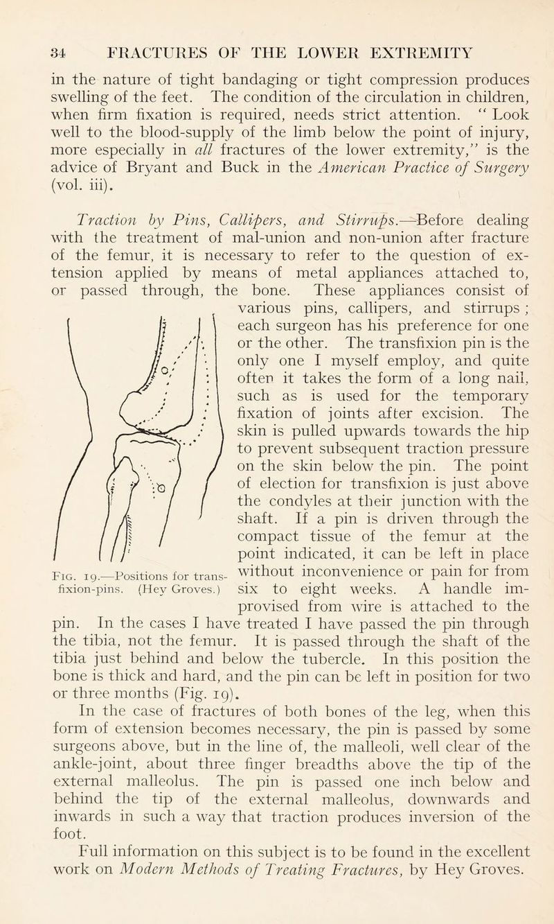 in the nature of tight bandaging or tight compression produces swelling of the feet. The condition of the circulation in children, when firm fixation is required, needs strict attention. “ Look well to the blood-supply of the limb below the point of injury, more especially in all fractures of the lower extremity/' is the advice of Bryant and Buck in the American Practice of Surgery (vol. iii). Traction by Pins, Callipers, and Stirrups.—Before dealing with the treatment of mal-union and non-union after fracture of the femur, it is necessary to refer to the question of ex¬ tension applied by means of metal appliances attached to, or passed through, the bone. These appliances consist of various pins, callipers, and stirrups; each surgeon has his preference for one or the other. The transfixion pin is the only one I myself employ, and quite often it takes the form of a long nail, such as is used for the temporary fixation of joints after excision. The skin is pulled upwards towards the hip to prevent subsequent traction pressure on the skin below the pin. The point of election for transfixion is just above the condyles at their junction with the shaft. If a pin is driven through the compact tissue of the femur at the point indicated, it can be left in place without inconvenience or pain for from six to eight weeks. A handle im¬ provised from wire is attached to the pin. In the cases I have treated I have passed the pin through the tibia, not the femur. It is passed through the shaft of the tibia just behind and below the tubercle. In this position the bone is thick and hard, and the pin can be left in position for two or three months (Fig. 19). In the case of fractures of both bones of the leg, when this form of extension becomes necessary, the pin is passed by some surgeons above, but in the line of, the malleoli, well clear of the ankle-joint, about three finger breadths above the tip of the external malleolus. The pin is passed one inch below and behind the tip of the external malleolus, downwards and inwards in such a way that traction produces inversion of the foot. Full information on this subject is to be found in the excellent work on Modern Methods of Treating Fractures, by Hey Groves. Fig. 19.—Positions for trans fixion-pins. (Hev Groves.)