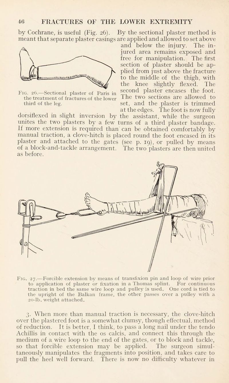 by Cochrane, is useful (Fig. 26). By the sectional plaster method is meant that separate plaster casings are applied and allowed to set above and below the injury. The in- US jured area remains exposed and ' 1 free for manipulation. The first section of plaster should be ap¬ plied from just above the fracture to the middle of the thigh, with the knee slightly flexed. The second plaster encases the foot. The two sections are allowed to set, and the plaster is trimmed at the edges. The foot is now fully dorsiflexed in slight inversion by the assistant, while the surgeon unites the two plasters by a few turns of a third plaster bandage. If more extension is required than can be obtained comfortably by manual traction, a clove-hitch is placed round the foot encased in its plaster and attached to the gates (see p. 19), or pulled by means of a block-and-tackle arrangement. The two plasters are then united as before. Fig. 26.—Sectional plaster of Paris in the treatment of fractures of the lower third of the leg. Fig. 27.—Forcible extension by means of transfixion pin and loop of wire prior to application of plaster or fixation in a Thomas splint. For continuous traction in bed the same wire loop and pulley is used. One cord is tied to the upright of the Balkan frame, the other passes over a pulley with a 20-lb. weight attached. 3. When more than manual traction is necessary, the clove-hitch over the plastered foot is a somewhat clumsy, though effectual, method of reduction. It is better, I think, to pass a long nail under the tendo Achillis in contact with the os calcis, and connect this through the medium of a wire loop to the end of the gates, or to block and tackle, so that forcible extension may be applied. The surgeon simul¬ taneously manipulates the fragments into position, and takes care to pull the heel well forward. There is now no difficulty whatever in