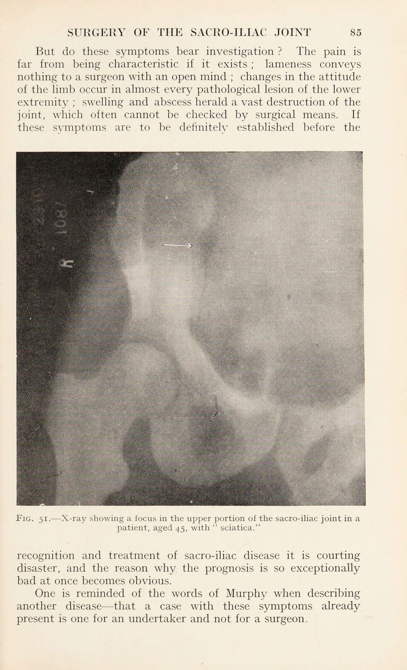 But do these symptoms bear investigation ? The pain is far from being characteristic if it exists ; lameness conveys nothing to a surgeon with an open mind ; changes in the attitude of the limb occur in almost every pathological lesion of the lower extremity ; swelling and abscess herald a vast destruction of the joint, which often cannot be checked by surgical means. If these symptoms are to be definitely established before the Fig. 51.—X-ray showing a focus in the upper portion of the sacro-iliac joint in a patient, aged 45, with “ sciatica.” recognition and treatment of sacro-iliac disease it is courting disaster, and the reason why the prognosis is so exceptionally bad at once becomes obvious. One is reminded of the words of Murphy when describing another disease—that a case with these symptoms already present is one for an undertaker and not for a surgeon.
