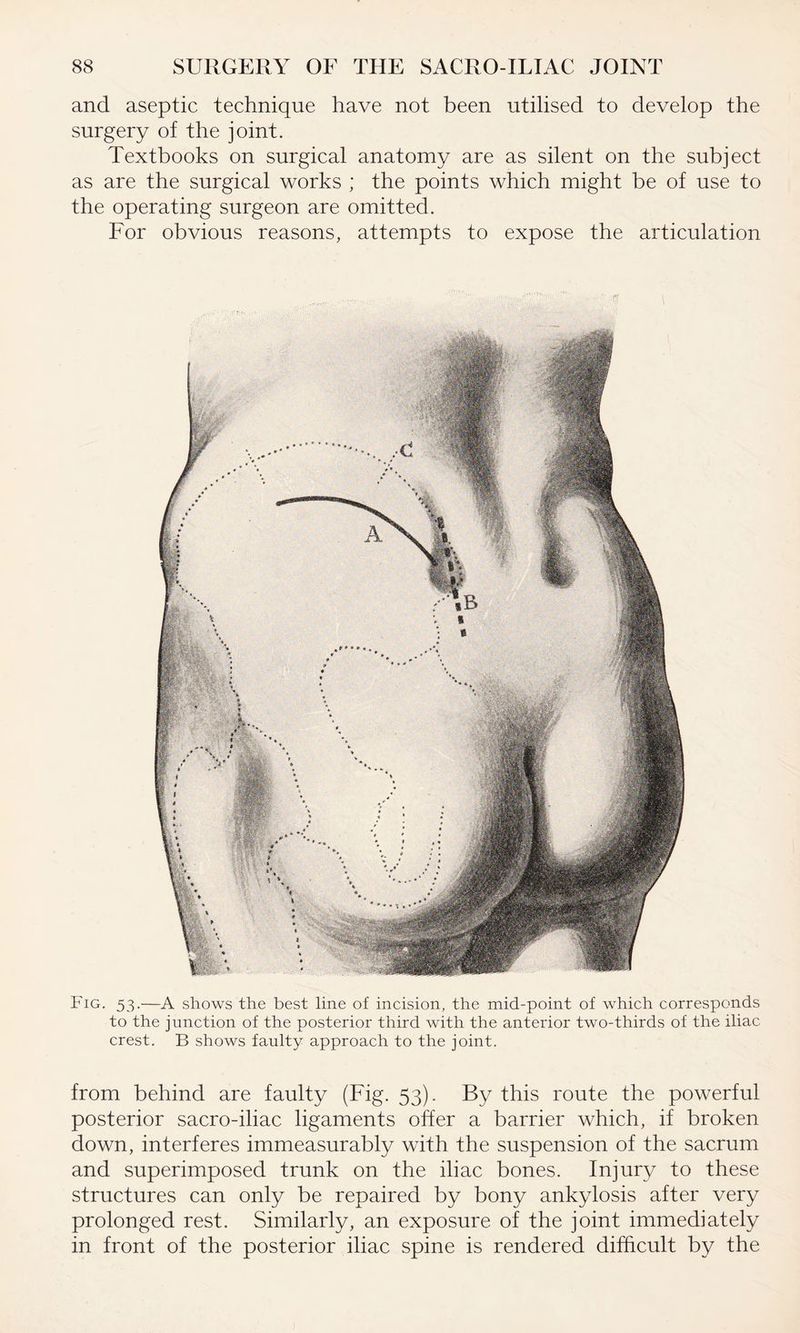 and aseptic technique have not been utilised to develop the surgery of the joint. Textbooks on surgical anatomy are as silent on the subject as are the surgical works ; the points which might be of use to the operating surgeon are omitted. For obvious reasons, attempts to expose the articulation Fig. 53.—A shows the best line of incision, the mid-point of which corresponds to the junction of the posterior third with the anterior two-thirds of the iliac crest. B shows faulty approach to the joint. from behind are faulty (Fig. 53). By this route the powerful posterior sacro-iliac ligaments offer a barrier which, if broken down, interferes immeasurably with the suspension of the sacrum and superimposed trunk on the iliac bones. Injury to these structures can only be repaired by bony ankylosis after very prolonged rest. Similarly, an exposure of the joint immediately in front of the posterior iliac spine is rendered difficult by the