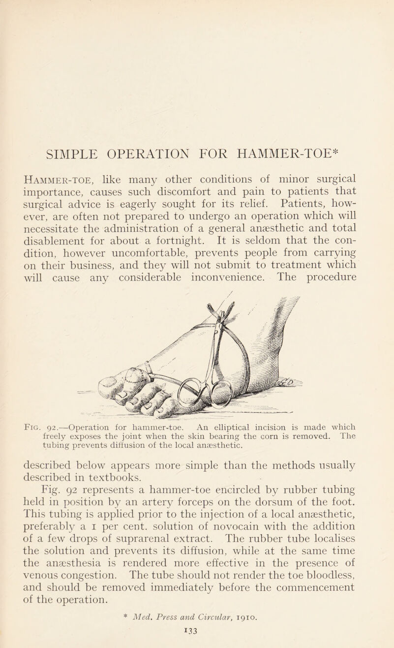 SIMPLE OPERATION FOR HAMMER-TOE* Hammer-toe, like many other conditions of minor surgical importance, causes such discomfort and pain to patients that surgical advice is eagerly sought for its relief. Patients, how¬ ever, are often not prepared to undergo an operation which will necessitate the administration of a general anaesthetic and total disablement for about a fortnight. It is seldom that the con¬ dition, however uncomfortable, prevents people from carrying on their business, and they will not submit to treatment which will cause any considerable inconvenience. The procedure Fig. 92.—Operation for hammer-toe. An elliptical incision is made which freely exposes the joint when the skin bearing the corn is removed. The tubing prevents diffusion of the local anaesthetic. described below appears more simple than the methods usually described in textbooks. Fig. 92 represents a hammer-toe encircled by rubber tubing held in position by an artery forceps on the dorsum of the foot. This tubing is applied prior to the injection of a local anaesthetic, preferably a 1 per cent, solution of novocain with the addition of a few drops of suprarenal extract. The rubber tube localises the solution and prevents its diffusion, while at the same time the anaesthesia is rendered more effective in the presence of venous congestion. The tube should not render the toe bloodless, and should be removed immediately before the commencement of the operation. * Med. Press and Circular, 1910.