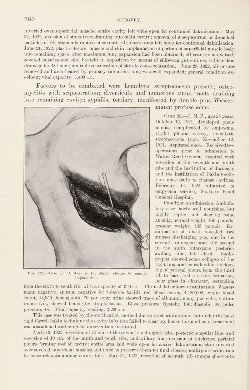 inverted over superficial muscle; entire cavity left wide open for continued dakinization. May 31, 1922, excision of sinus tract draining into main cavity; removal of a sequestrum or detached particles of rib fragments in area of seventh rib; entire area left open for continued dakinization. June 21, 1922, plastic closure, muscle and skin; implantation of portion of superficial muscle body into remaining space; after maximum lung expansion had been obtained; all scar tissue excised; severed muscles and skin brought in apposition by means of silkworm gut sutures; rubber dam drainage for 48 hours; multiple scarification of skin to cause relaxation. June 28, 1922, all sutures removed and area healed by primary intention; lung was well expanded; general condition ex¬ cellent; vital capacity, 3,400 c.c. Factors to be combated were hemolytic streptococcus present; osteo¬ myelitis with sequestration; diverticula and numerous sinus tracts draining into remaining cavity; syphilis, tertiary, manifested by double plus Wasser- mann; profuse acne. Case 32.—J. M. P., age 28 years. October 12, 1921, developed pneu¬ monia; complicated by empyema, right pleural cavity, hemolytic streptococcus type, November 12, 1921. Aspirated once. Received two operations prior to admission to Walter Reed General Hospital, with resection of the seventh and ninth ribs and the institution of drainage, and the instillation of Dakin’s solu¬ tion once daily to cleanse cavities. February 14, 1922, admitted to empyema service, Walter Reed General Hospital. Condition on admission: Ambula¬ tory case; fairly well nourished but highly septic and showing some anemia; normal weight, 150 pounds; present weight, 133 pounds. Ex¬ amination of chest revealed two sinuses discharging pus, one in the seventh interspace and the second in the ninth interspace, posterior axillary line, left chest. Radio¬ graphs showed some collapse of the right lung and considerable thicken¬ ing of parietal pleura from the third rib to base, and a cavity formation, hour glass in character, extending from the sixth to tenth rib, with a capacity of 350 c.c. Clinical laboratory examination: Wasser- mann negative; sputum negative for tubercle bacilli; red blood count, 4,180,000; white blood count, 18,950; hemoglobin, 70 per cent; urine showed trace of albumin, many pus cells; culture from cavity showed hemolytic streptococcus. Blood pressure: Systolic, 136; diastolic, 88; pulse pressure, 48. Vital capacity reading, 2,200 c.c. This case was treated by the sterilization method due to its short duration; but under the most rigid Carrel-Dakin technique the cavity infection failed to clear up, hence this method of treatment was abandoned and surgical intervention instituted. April 10, 1922, resection of 15 cm. of the seventh and eighth ribs, posterior scapular line, and resection of 10 cm. of the ninth and tenth ribs, midaxillary line; excision of thickened parietal pleura forming roof of cavity; entire area laid wide open for active dakinization; skin inverted over severed superficial muscles and fixed to preserve them for final closure; multiple scarification to cause relaxation along suture line. May 25, 1922, resection of necrotic rib stumps of seventh Fig. 124.—Case 33: A stage in the plastic closure by muscle implantation.