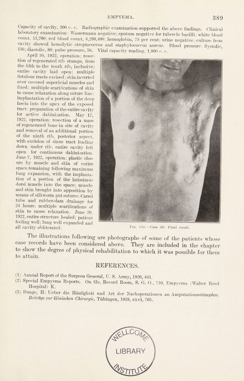 Capacity of cavity, 300 c. c. Radiographic examination supported the above findings. Clinical laboratory examination: Wassermann negative; sputum negative for tubercle bacilli; white blood count, 13,700; red blood count, 4,280,400; hemoglobin, 75 per cent; urine negative; culture from cavity showed hemolytic streptococcus and staphylococcus aureus. Blood pressure: Systolic, 136; diastolic, 80; pulse pressure, 56. Vital capacity reading, 1,800 c. c. April 10, 1922, operation; resec¬ tion of regenerated rib stumps, from the fifth to the tenth rib, inclusive; entire cavity laid open; multiple fistulous tracts excised; skin inverted over covered superficial muscles and fixed; multiple scarifications of skin to cause relaxation along suture line; implantation of a portion of the deep fascia into the apex of the exposed tract; preparation of the entire cavity for active dakinization. May 17, 1922, operation; resection of a mass of regenerated bone in site of cavity and removal of an additional portion of the ninth rib, posterior aspect, with excision of sinus tract leading down under rib; entire cavity left open for continuous dakinization. June 7, 1922, operation; plastic clos¬ ure by muscle and skin of entire space remaining following maximum lung expansion, with the implanta¬ tion of a portion of the latissimus dorsi muscle into the space; muscle and skin brought into apposition by means of silkworm gut sutures: Carrel tube and rubber-dam drainage for 24 hours; multiple scarifications of skin to cause relaxation. June 20, 1922, entire structure healed; patient feeling well; lung well expanded and all cavity obliterated. Fig. 134.-—Case 39: Final result. The illustrations following are photographs of some of the patients whose case records have been considered above. They are included in the chapter to show the degree of physical rehabilitation to which it was possible for them to attain. REFERENCES. (1) Annual Report of the Surgeon General, XT. S. Army, 1920, 441. (2) Special Empyema Reports. On file, Record Room, S. G. O., 710, Empvema (Walter Reed Hospital) K. (.) ) Bunge, H: Ueber die Haufigkeit und Art der Nachoperationen an Amputationsstumpfen. Beitrage zur klinischen Chirurgie, Tubingen, 1919, cxvi, 705. B LIBRARY