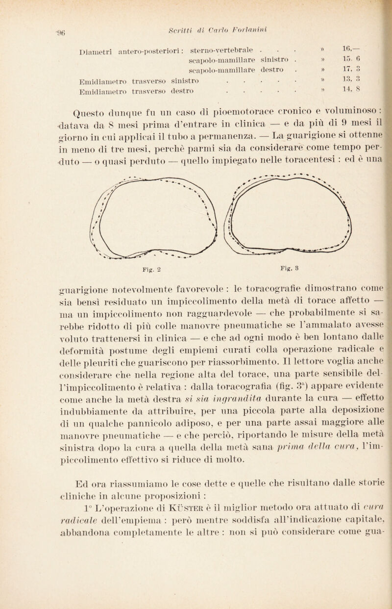 Diametri antero-posteriori : sterno-vertebrale . scapolo-mamillare sinistro scapolo-mamillare destro Emidiametro trasverso sinistro .... Emidiamet.ro trasverso destro .... )■> » )> » » lG- 15. 0 17, 3 -i O 9 lo, o 14, 8 Questo dunque fu un caso di pioemotorace cronico e voluminoso : datava da 8 mesi prima d’entrare in clinica — e da più di 9 mesi il giorno in cui applicai il tubo a permanenza. — La guarigione si ottenne in meno di tre mesi, perche panni sia da considerare come tempo per¬ duto — o quasi perduto — quello impiegato nelle toracentesi : ed è una ■guarigione notevolmente favorevole : le toracografìe dimostrano come sia bensì residuato un impicco]intento della metà di torace affetto — ina un impiccolimento non ragguardevole — che probabilmente si sa¬ rebbe ridotto di più colle manovre pneumatiche se l’ammalato avesse voluto trattenersi in clinica — e che ad ogni modo è ben lontano dalle deformità postume degli empiemi curati colla operazione radicale e delle pleuriti che guariscono per riassorbimento. Il lettore voglia anche considerare che nella regione alta del torace, una parte sensibile del- rimpiccolimento è relativa : dalla toracografia (fìg. 3a) appare evidente come anche la metà destra si sia ingrandita durante la cura — effetto indubbiamente da attribuire, per una piccola parte alla deposizione di un qualche pannicolo adiposo, e per una parte assai maggiore alle manovre pneumatiche — e che perciò, riportando le misure della metà sinistra dopo la cura a quella della metà sana prima della cura, l'im- piccolimento effettivo si riduce di molto. Ed ora riassumiamo le cose dette e quelle che risultano dalle storie cliniche in alcune proposizioni : 1° L’operazione di Kùster è il miglior metodo ora attuato di cura radicale delFempiema : però mentre soddisfa all’indicazione capitale, abbandona completamente le altre : non si può considerare come gua-