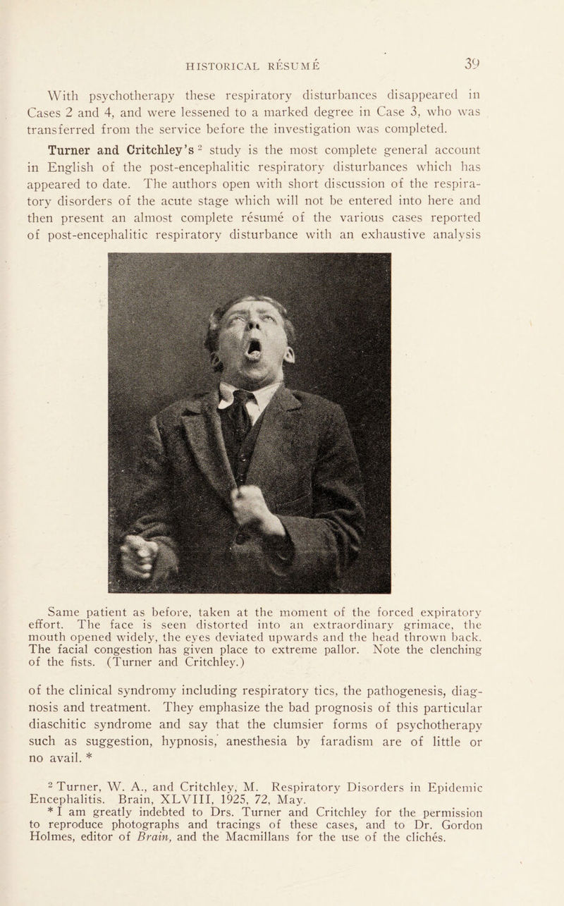 With psychotherapy these respiratory disturbances disappeared in Cases 2 and 4, and were lessened to a marked degree in Case 3, who was transferred from the service before the investigation was completed. Turner and Critchley’s 2 study is the most complete general account in English of the post-encephalitic respiratory disturbances which has appeared to date. The authors open with short discussion of the respira¬ tory disorders of the acute stage which will not be entered into here and then present an almost complete resume of the various cases reported of post-encephalitic respiratory disturbance with an exhaustive analysis Same patient as before, taken at the moment of the forced expiratory effort. The face is seen distorted into an extraordinary grimace, the mouth opened widely, the eyes deviated upwards and the head thrown back. The facial congestion has given place to extreme pallor. Note the clenching of the fists. (Turner and Critchley.) of the clinical syndromy including respiratory tics, the pathogenesis, diag¬ nosis and treatment. They emphasize the bad prognosis of this particular diaschitic syndrome and say that the clumsier forms of psychotherapy such as suggestion, hypnosis, anesthesia by faradism are of little or no avail. * 2 Turner, W. A., and Critchley, M. Respiratory Disorders in Epidemic Encephalitis. Brain, XLVIII, 1925, 72, May. * I am greatly indebted to Drs. Turner and Critchley for the permission to reproduce photographs and tracings of these cases, and to Dr. Gordon Holmes, editor of Brain, and the Macmillans for the use of the cliches.