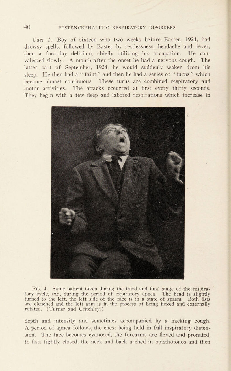 Case 1. Boy of sixteen who two weeks before Easter, 1924, had drowsy spells, followed by Easter by restlessness, headache and fever, then a four-day delirium, chiefly utilizing his occupation. He con¬ valesced slowly. A month after the onset he had a nervous cough. The latter part of September, 1924, he would suddenly waken from his sleep. He then had a “ faint,” and then he had a series of “ turns ” which became almost continuous. These turns are combined respiratory and motor activities. The attacks occurred at first every thirty seconds. They begin with a few deep and labored respirations which increase in Fig. 4. Same patient taken during the third and final stage of the respira¬ tory cycle, viz., during the period of expiratory apnea. The head is slightly turned to the left, the left side of the face is in a state of spasm. Both fists are clenched and the left arm is in the process of being flexed and externally rotated. (Turner and Critchley.) depth and intensity and sometimes accompanied by a hacking cough. A period of apnea follows, the chest being held in full inspiratory disten¬ sion. The face becomes cyanosed, the forearms are flexed and pronated, to fists tightly closed, the neck and back arched in opisthotonos and then