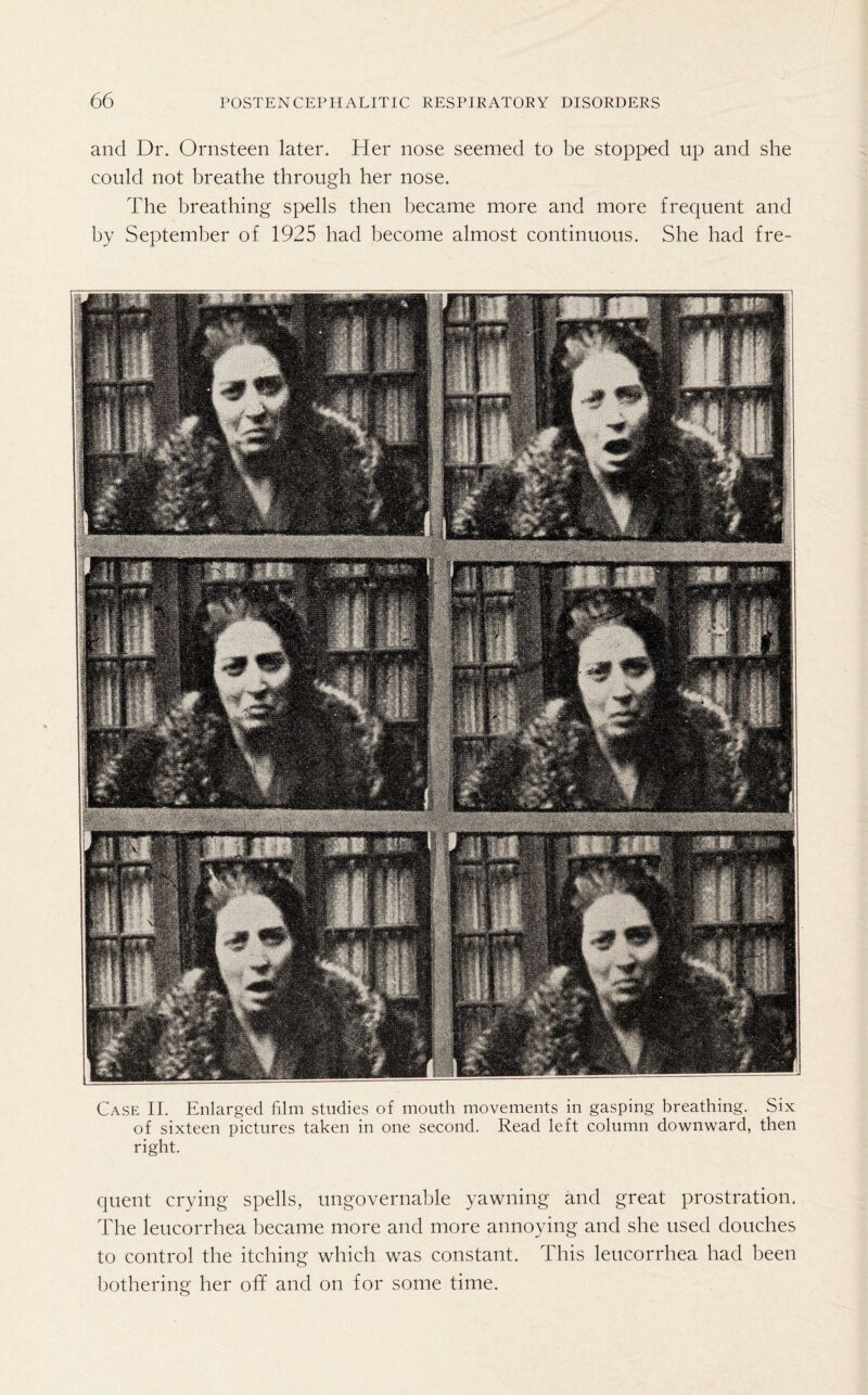 and Dr. Ornsteen later. Her nose seemed to be stopped up and she could not breathe through her nose. The breathing spells then became more and more frequent and by September of 1925 had become almost continuous. She had fre- Case II. Enlarged film studies of mouth movements in gasping breathing. Six of sixteen pictures taken in one second. Read left column downward, then right. quent crying spells, ungovernable yawning and great prostration. The leucorrhea became more and more annoying and she used douches to control the itching which was constant. This leucorrhea had been bothering her off and on for some time.