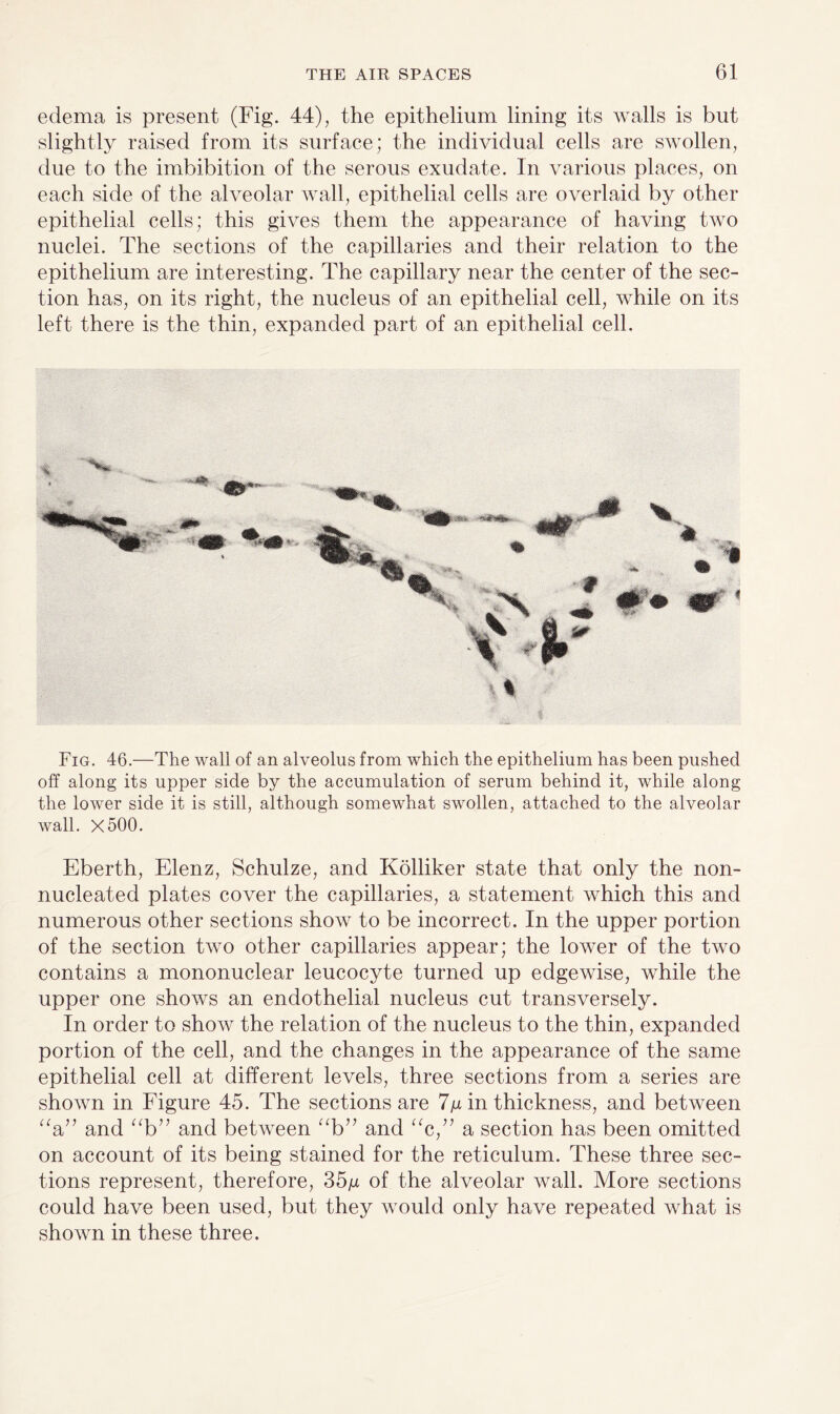 edema is present (Fig. 44), the epithelium lining its walls is but slightly raised from its surface; the individual cells are swollen, due to the imbibition of the serous exudate. In various places, on each side of the alveolar wall, epithelial cells are overlaid by other epithelial cells; this gives them the appearance of having two nuclei. The sections of the capillaries and their relation to the epithelium are interesting. The capillary near the center of the sec¬ tion has, on its right, the nucleus of an epithelial cell, while on its left there is the thin, expanded part of an epithelial cell. Fig. 46.—The wall of an alveolus from which the epithelium has been pushed off along its upper side by the accumulation of serum behind it, while along the lower side it is still, although somewhat swollen, attached to the alveolar wall. X500. Eberth, Elenz, Schulze, and Kolliker state that only the non- nucleated plates cover the capillaries, a statement which this and numerous other sections show to be incorrect. In the upper portion of the section two other capillaries appear; the lower of the two contains a mononuclear leucocyte turned up edgewise, while the upper one shows an endothelial nucleus cut transversely. In order to show the relation of the nucleus to the thin, expanded portion of the cell, and the changes in the appearance of the same epithelial cell at different levels, three sections from a series are shown in Figure 45. The sections are 7g in thickness, and between “a” and ab” and between “b” and “c,” a section has been omitted on account of its being stained for the reticulum. These three sec¬ tions represent, therefore, 35/x of the alveolar wall. More sections could have been used, but they would only have repeated what is shown in these three.