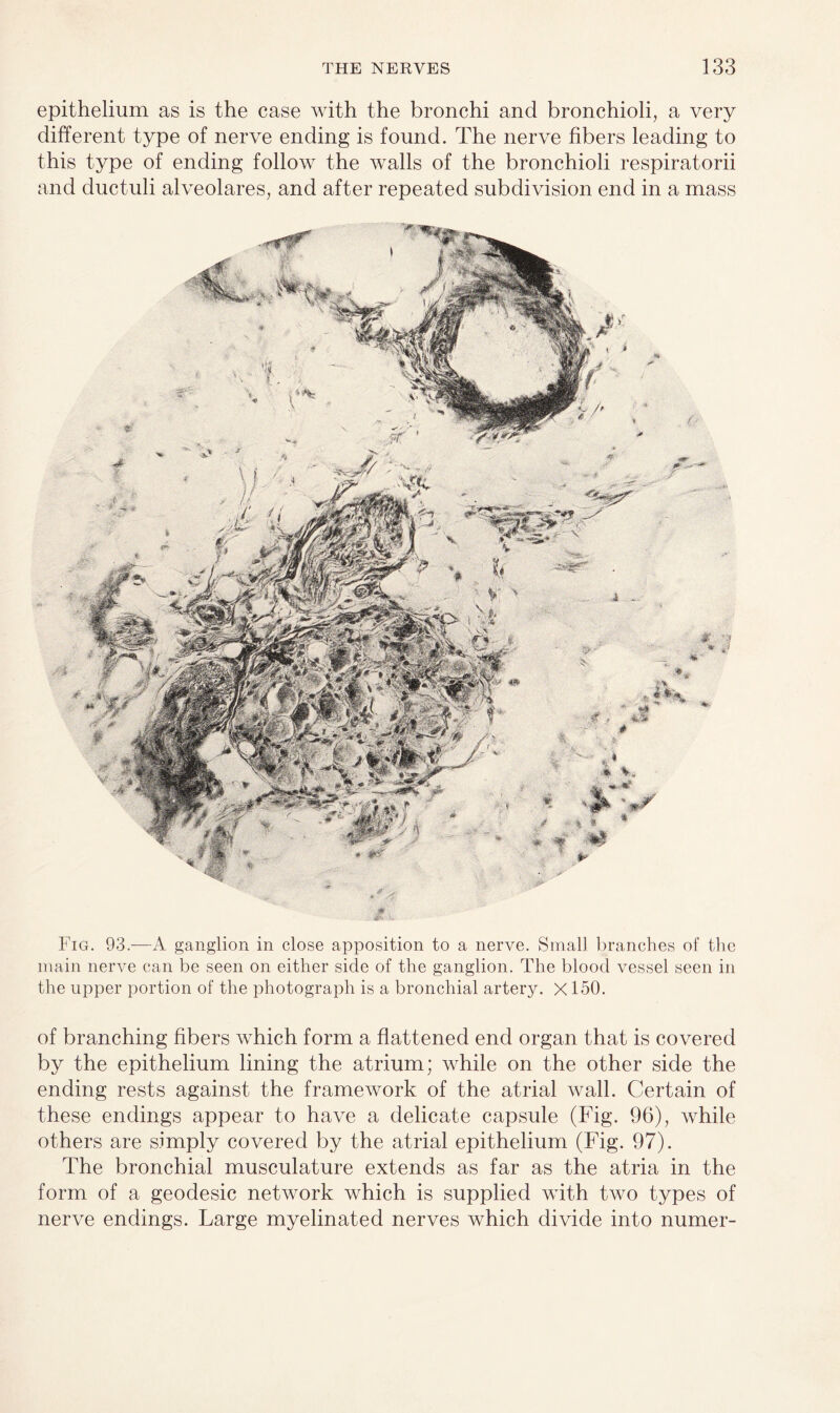 epithelium as is the case with the bronchi and bronchioli, a very different type of nerve ending is found. The nerve fibers leading to this type of ending follow the walls of the bronchioli respiratorii and ductuli alveolares, and after repeated subdivision end in a mass Fig. 93.—A ganglion in close apposition to a nerve. Small branches of the main nerve can be seen on either side of the ganglion. The blood vessel seen in the upper portion of the photograph is a bronchial artery. X150. of branching fibers which form a flattened end organ that is covered by the epithelium lining the atrium; while on the other side the ending rests against the framework of the atrial wall. Certain of these endings appear to have a delicate capsule (Fig. 96), while others are simply covered by the atrial epithelium (Fig. 97). The bronchial musculature extends as far as the atria in the form of a geodesic network which is supplied with two types of nerve endings. Large myelinated nerves which divide into numer-