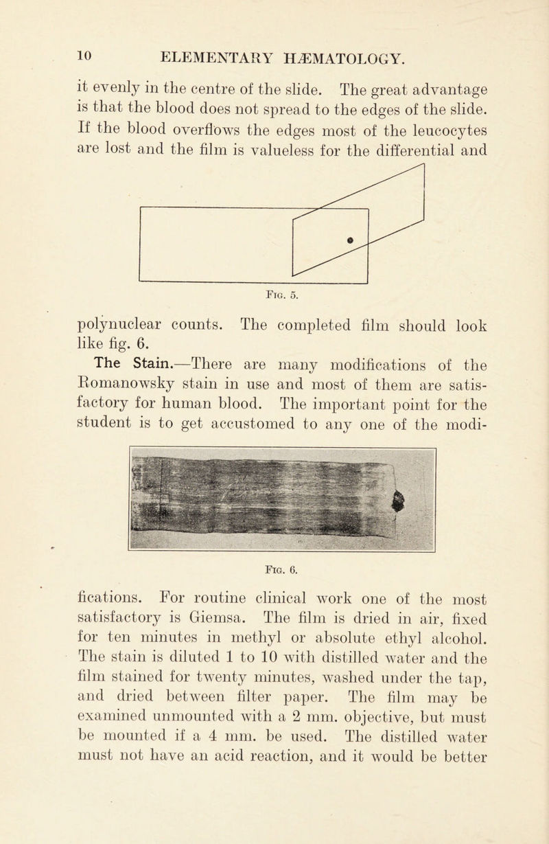 it evenly in the centre of the slide. The great advantage is that the blood does not spread to the edges of the slide. If the blood overflows the edges most of the leucocytes are lost and the film is valueless for the differential and polynuclear counts. The completed film should look like fig. 6. The Stain.—There are many modifications of the Romanowsky stain in use and most of them are satis¬ factory for human blood. The important point for the student is to get accustomed to any one of the modi- Fig. 6. fications. For routine clinical work one of the most satisfactory is Giemsa. The film is dried in air, fixed for ten minutes in methyl or absolute ethyl alcohol. The stain is diluted 1 to 10 with distilled water and the film stained for twenty minutes, washed under the tap, and dried between filter paper. The film may be examined unmounted with a 2 mm. objective, but must be mounted if a 4 mm. be used. The distilled water must not have an acid reaction, and it would be better