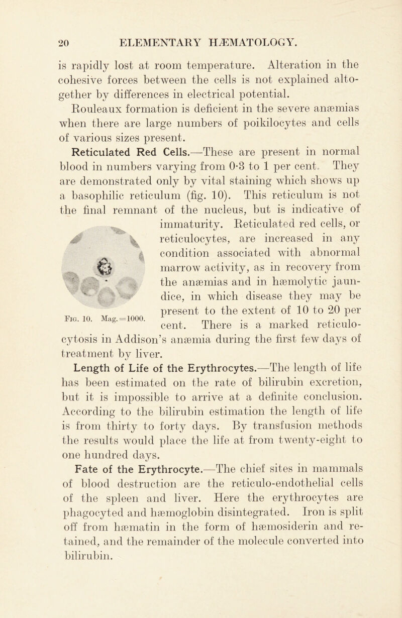 ^ 13*, Bil  is rapidly lost at room temperature. Alteration in the cohesive forces between the cells is not explained alto¬ gether by differences in electrical potential. Rouleaux formation is deficient in the severe anaemias when there are large numbers of poikilocytes and cells of various sizes present. Reticulated Red Cells.—These are present in normal blood in numbers varying from 0-8 to 1 per cent. They are demonstrated only by vital staining which shows up a basophilic reticulum (fig. 10). This reticulum is not the final remnant of the nucleus, but is indicative of immaturity. Reticulated red cells, or reticulocytes, are increased in any condition associated with abnormal marrow activity, as in recovery from the anaemias and in haemolytic jaun¬ dice, in which disease they may be present to the extent of 10 to 20 per cent. There is a marked reticulo- cytosis in Addison’s anaemia during the first few days of treatment by liver. Length of Life of the Erythrocytes.- —The length of life has been estimated on the rate of bilirubin excretion, but it is impossible to arrive at a definite conclusion. According to the bilirubin estimation the length of life is from thirty to forty days. By transfusion methods the results would place the life at from twenty-eight to one hundred days. Fate of the Erythrocyte.—The chief sites in mammals of blood destruction are the reticulo-endothelial cells of the spleen and liver. Here the erythrocytes are phagocyted and haemoglobin disintegrated. Iron is split off from haematin in the form of haemosiderin and re¬ tained, and the remainder of the molecule converted into bilirubin. Fig. 10. Mag. = 1000.