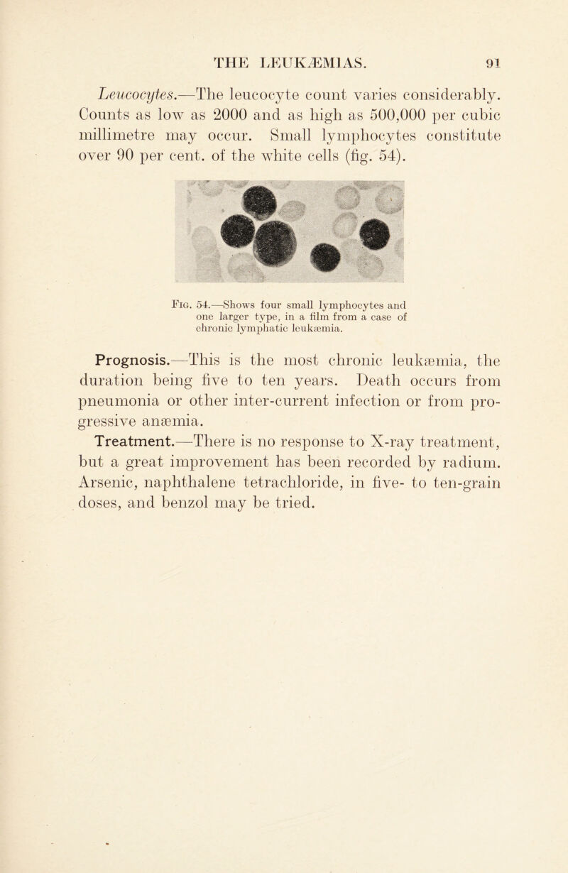 Leucocytes.—The leucocyte count varies considerably. Counts as low as 2000 and as high as 500,000 per cubic millimetre may occur. Small lymphocytes constitute over 90 per cent, of the white cells (tig. 54). Fig. 54.—Shows four small lymphocytes and one larger type, in a film from a case of chronic lymphatic leukaemia. Prognosis.—This is the most chronic leukaemia, the duration being five to ten years. Death occurs from pneumonia or other inter-current infection or from pro¬ gressive anaemia. Treatment.—-There is no response to X-ray treatment, but a great improvement has been recorded by radium. Arsenic, naphthalene tetrachloride, in five- to ten-grain doses, and benzol may be tried.
