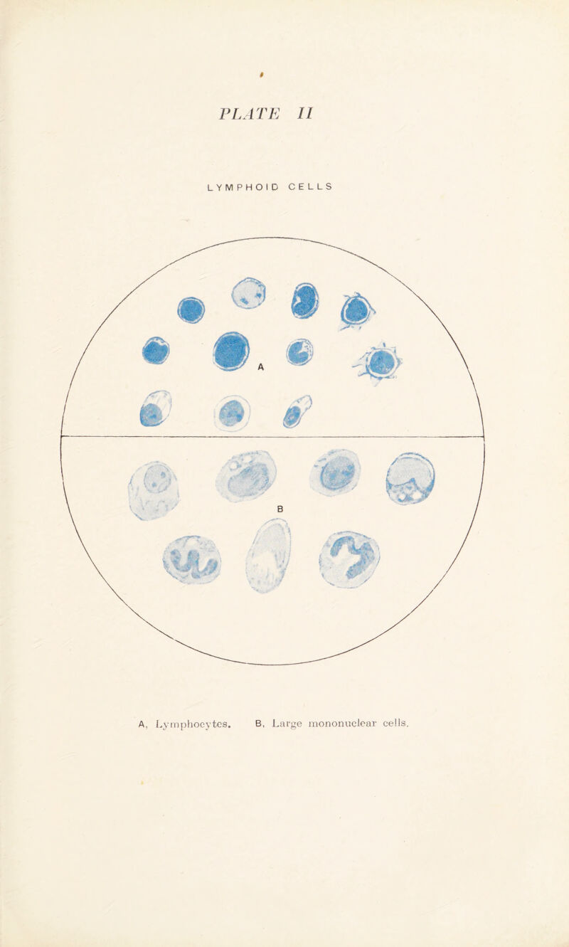 t PLATE II LYMPHOID CELLS A, Lymphocytes. B, Large mononuclear cells.