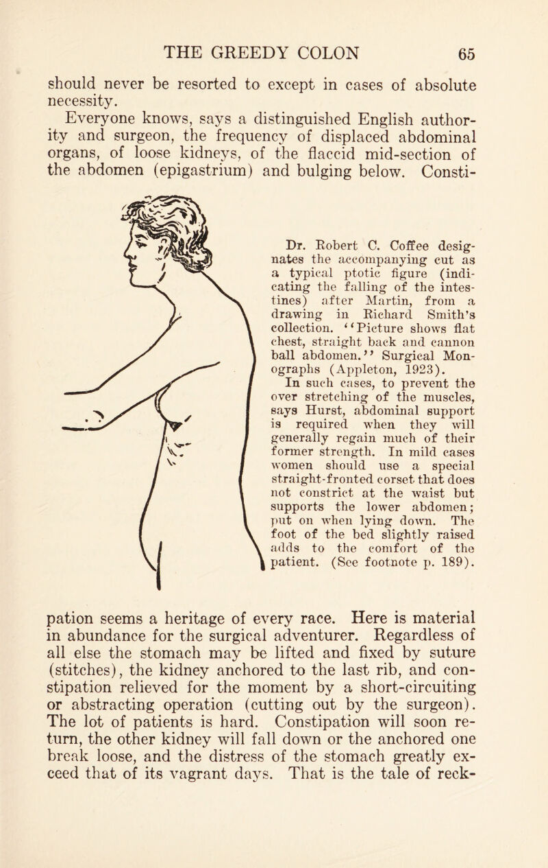 should never be resorted to except in cases of absolute necessity. Everyone knows, says a distinguished English author¬ ity and surgeon, the frequency of displaced abdominal organs, of loose kidneys, of the flaccid mid-section of the abdomen (epigastrium) and bulging below. Consti- Dr. Robert C. Coffee desig¬ nates the accompanying cut as a typical ptotic figure (indi¬ cating the falling of the intes¬ tines) after Martin, from a drawing in Richard Smith’s collection. ‘1 Picture shows flat chest, straight back and cannon ball abdomen. ” Surgical Mon¬ ographs (Appleton, 1923). In such cases, to prevent the over stretching of the muscles, says Hurst, abdominal support is required when they will generally regain much of their former strength. In mild cases women should use a special straight-fronted corset that does not constrict at the waist but supports the lower abdomen; put on when lying down. The foot of the bed slightly raised adds to the comfort of the patient. (See footnote p. 189). pation seems a heritage of every race. Here is material in abundance for the surgical adventurer. Regardless of all else the stomach may be lifted and fixed by suture (stitches), the kidney anchored to the last rib, and con¬ stipation relieved for the moment by a short-circuiting or abstracting operation (cutting out by the surgeon). The lot of patients is hard. Constipation will soon re¬ turn, the other kidney will fall down or the anchored one break loose, and the distress of the stomach greatly ex¬ ceed that of its vagrant days. That is the tale of reck-