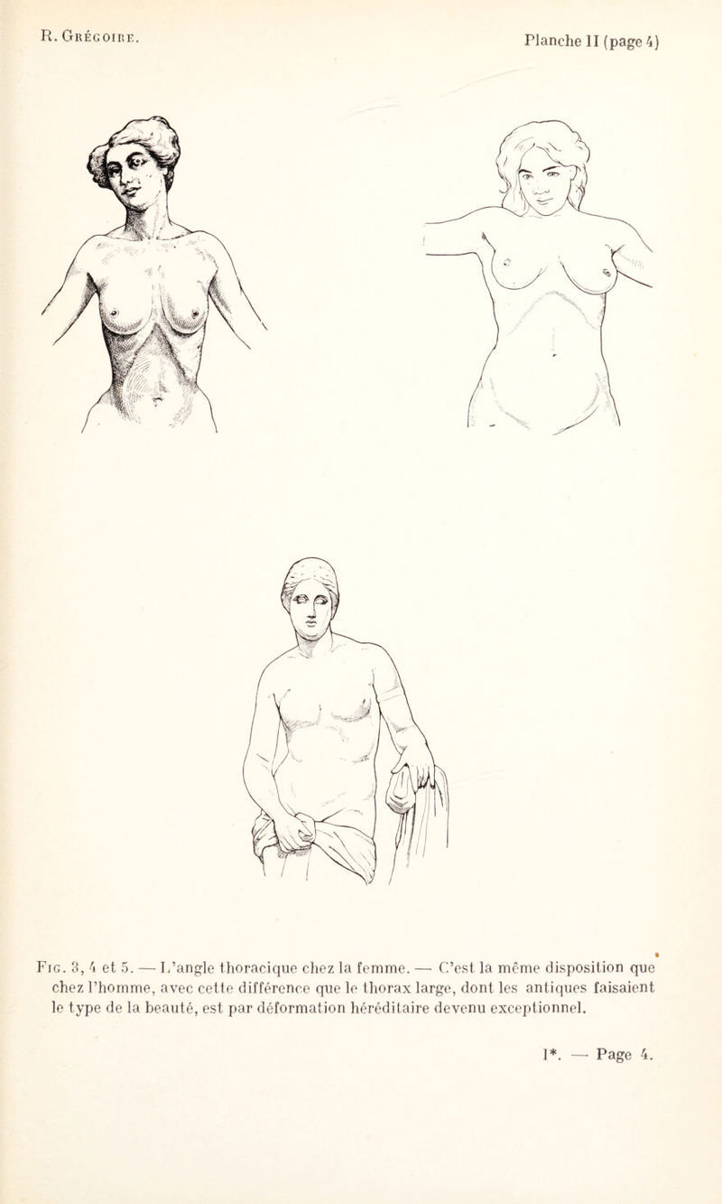 Fig. 3, 4 et 5. — L’angle thoracique chez la femme. — C’est la même disposition que chez l’homme, avec cette différence que le thorax large, dont les antiques faisaient le type de la beauté, est par déformation héréditaire devenu exceptionnel. 1*. Page 4.