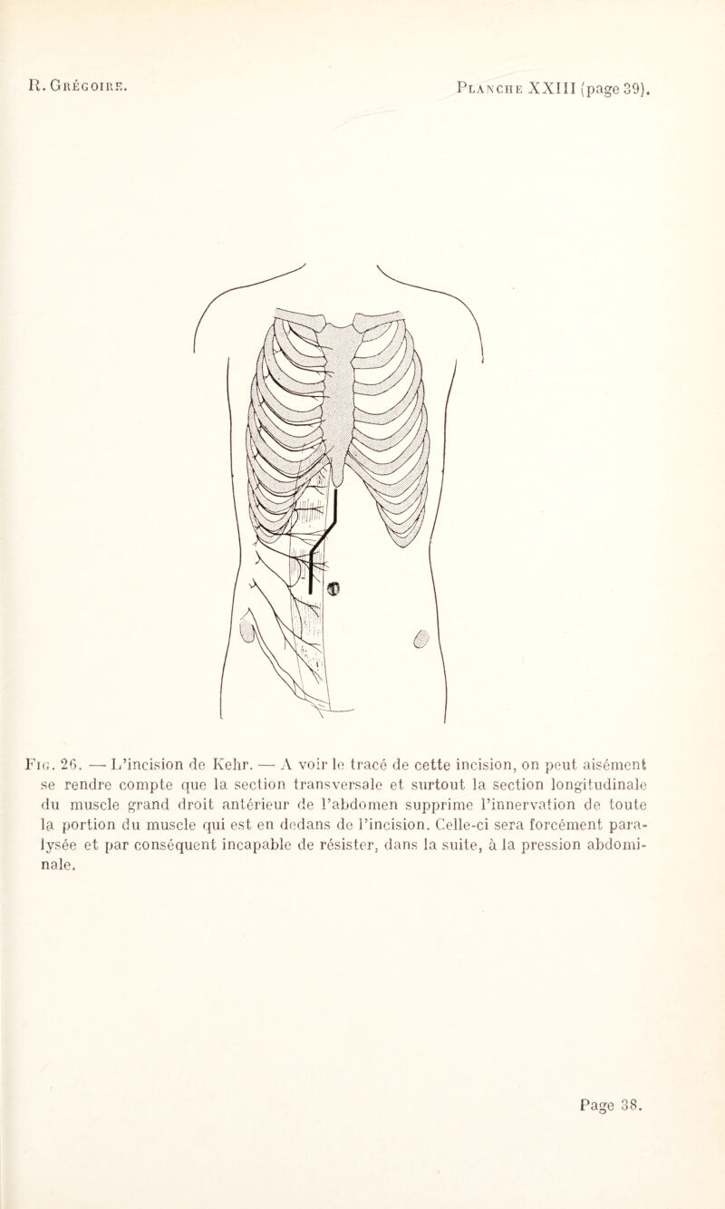 Fig. 26. — L’incision de Kehr. —■ A voir le tracé de cette incision, on peut aisément se rendre compte que la section transversale et surtout la section longitudinale du muscle grand droit antérieur de l’abdomen supprime l’innervation de toute la portion du muscle qui est en dedans de l’incision. Celle-ci sera forcément para¬ lysée et par conséquent incapable de résister, dans la suite, à la pression abdomi¬ nale.