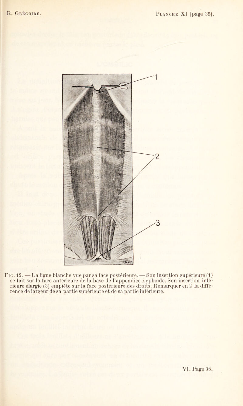 Fig. 12. — La ligne blanche vue par sa face postérieure. — Son insertion supérieure (1 ) se fait sur la face antérieure de la base de l’appendice xyphoïde. Son insertion infé¬ rieure élargie (3) empiète sur la face postérieure des droits. Remarquer en 2 la diffé¬ rence de largeur de sa partie supérieure et de sa partie inférieure.