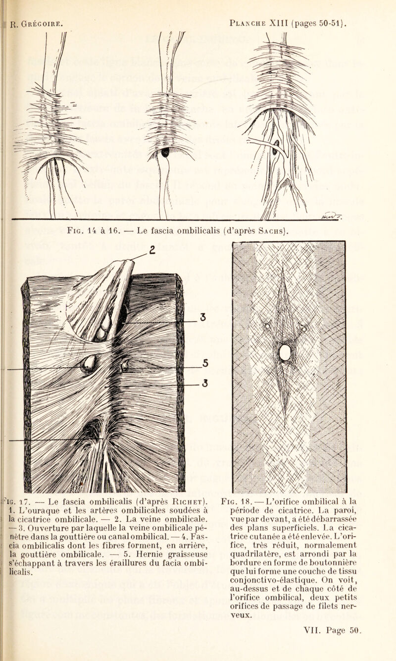 I Fig. 14 à 16. — Le fascia ombilicalis (d’après Sachs). |ÉiG. 17. — Le fascia ombilicalis (d’après Richet). 1. L’ouraque et les artères ombilicales soudées à i la cicatrice ombilicale.— 2. La veine ombilicale. • — 3. Ouverture par laquelle la veine ombilicale pé- ' nètre dans la gouttière ou canal ombilical. — 4. Fas- : cia ombilicalis dont les fibres forment, en arrière, , la gouttière ombilicale. —■ 5. Hernie graisseuse < s’échappant à travers les éraillures du facia ombi- ^ licalis. ] 1 Fig. 18. — L’orifice ombilical à la période de cicatrice. La paroi, vue par devant, a été débarrassée des plans superficiels. La cica¬ trice cutanée a été enlevée. L’ori¬ fice, très réduit, normalement quadrilatère, est arrondi par la bordure en forme de boutonnière que lui forme une couche de tissu conjonctivo-élastique. On voit, au-dessus et de chaque côté de l’orifice ombilical, deux petits orifices de passage de filets ner¬ veux.