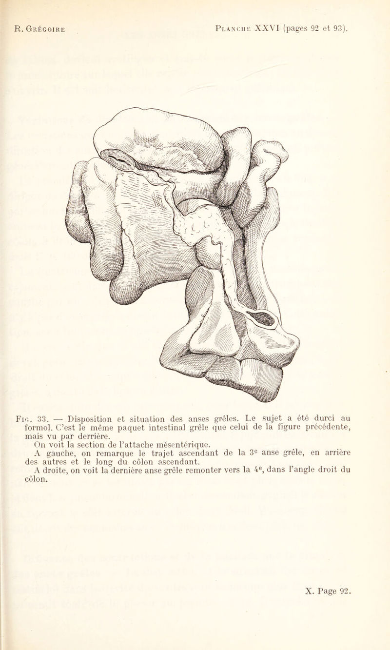 Fig. 33. —■ Disposition et situation des anses grêles. Le sujet a été durci au formol. C’est le même paquet intestinal grêle (jue celui de la figure précédente, mais vu par derrière. On voit la section de l’attache mésentérique. A gauche, on remarque le trajet ascendant de la 3® anse grêle, en arrière des autres et le long du côlon ascendant. A droite, on voit la dernière anse grêle remonter vers la 4®, dans l’angle droit du côlon.