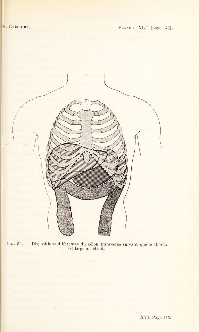 R. Grégoire. Planche XLII (page 146). Fig. 53. — Dispositions différentes du côlon transverse suivant que le thorax est large ou étroit.