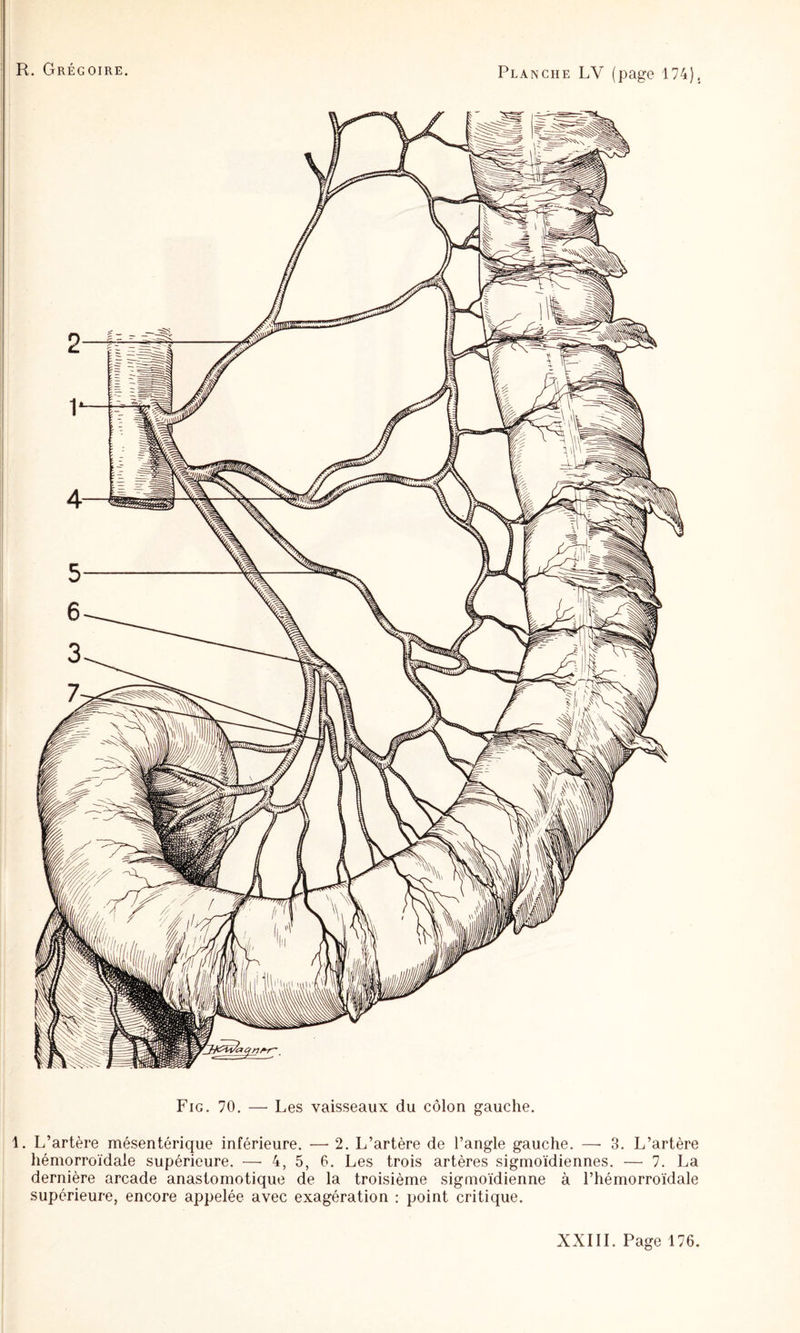 Fig. 70. — Les vaisseaux du côlon gauche. 1. L’artère mésentérique inférieure. — 2. L’artère de l’angle gauche. —• 3. L’artère hémorroïdale supérieure. — 4, 5, 6. Les trois artères sigmoïdiennes. — 7. La dernière arcade anastomotique de la troisième sigmoïdienne à l’hémorroïdale supérieure, encore appelée avec exagération : point critique.