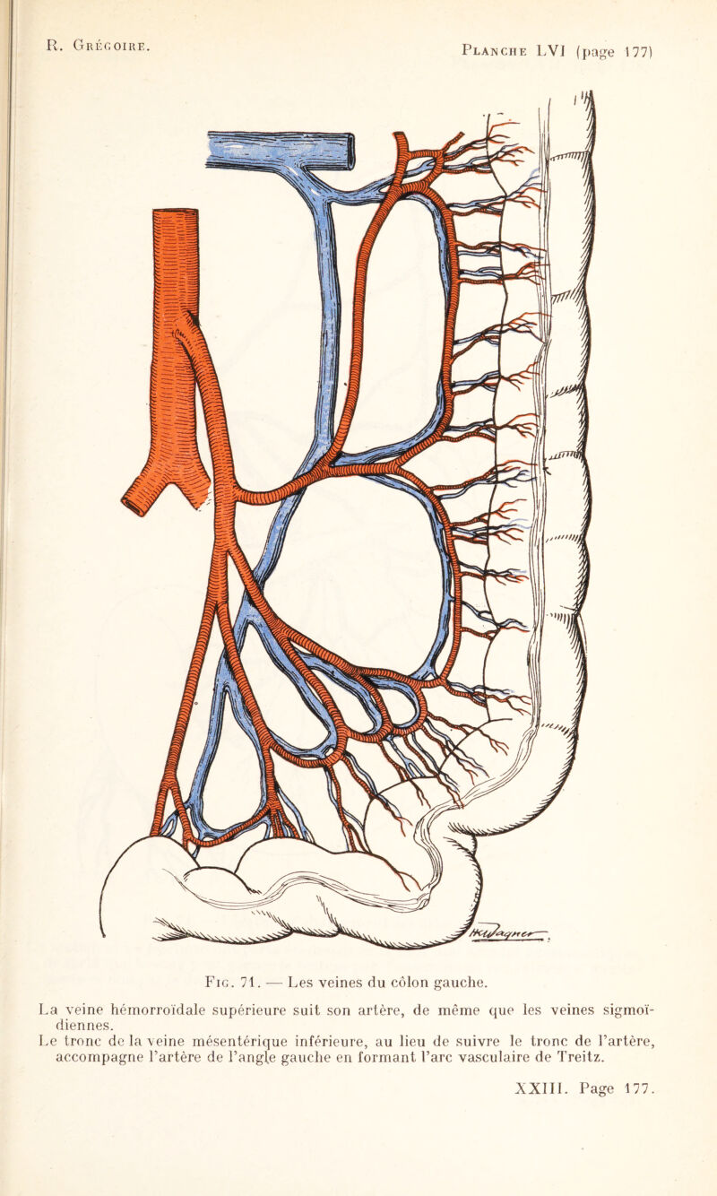 Fig. 71. ■— Les veines du côlon gauche. La veine hémorroïdale supérieure suit son artère, de même que les veines sigmoï¬ diennes. Le tronc de la veine mésentérique inférieure, au lieu de suivre le tronc de Fartère, accompagne Fartère de Fangle gauche en formant Farc vasculaire de Treitz.