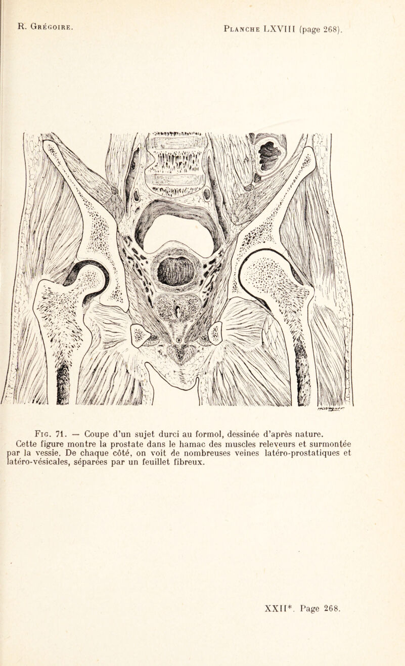 Fig. 71. — Coupe d’un sujet durci au formol, dessinée d’après nature. Cette figure montre la prostate dans le hamac des muscles releveurs et surmontée par la vessie. De chaque côté, on voit de nombreuses veines latéro-prostatiques et latéro-vésicales, séparées par un feuillet fibreux.