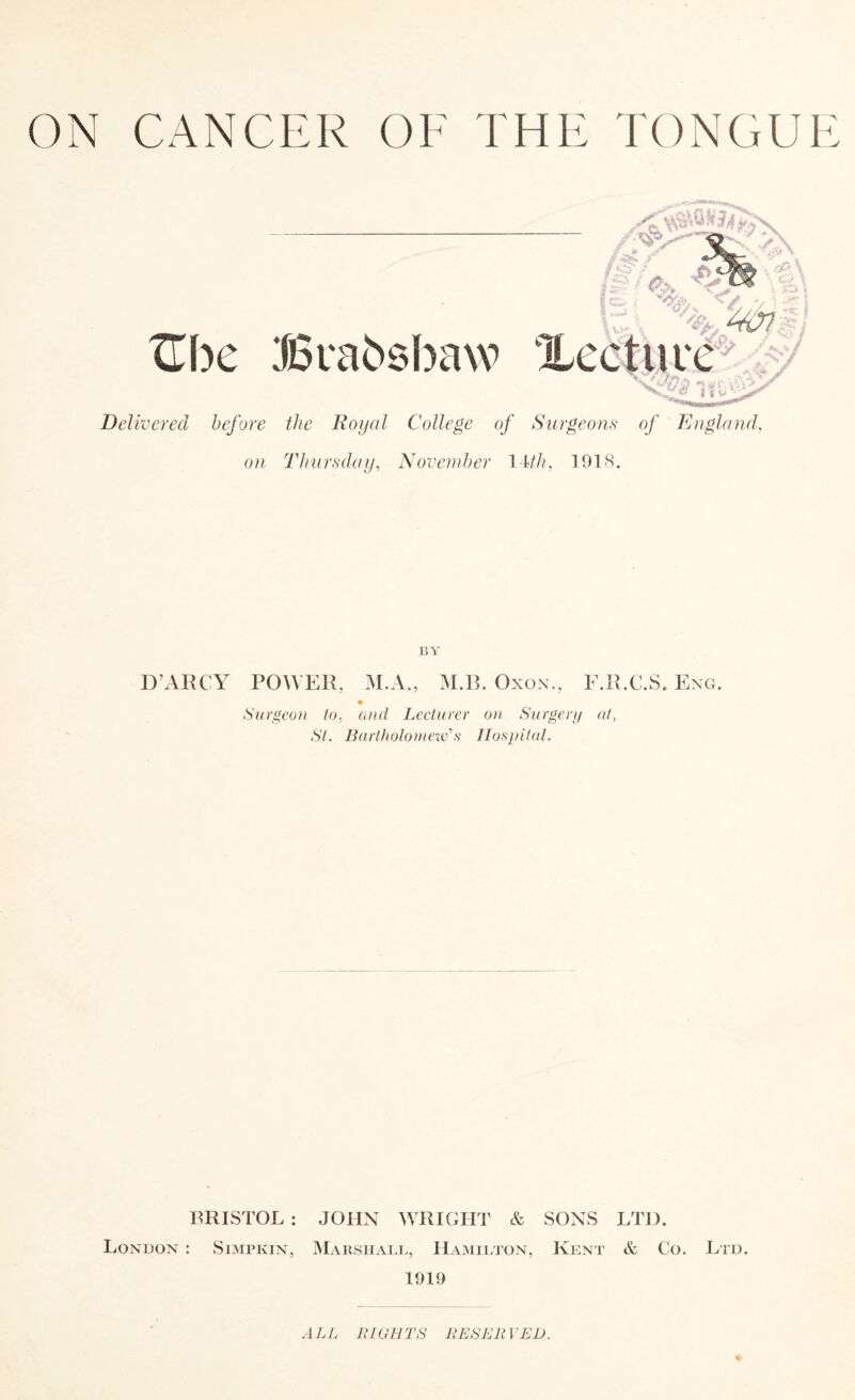 ON CANCER OF THE TONGUE y- TLbc J6ra6sbaw Xecture^ ni •;V Delivered before the Royal College of Surgeons of England, on Thursday, Noveinher \Mh, 1918. BY D’ARCY POWER, M.A., M.B. OxoN., E.R.C.S. Eng. Surgco)i to, and Lecturer on Surgery at, St. Bartholoniexv's llospitul. BRISTOL : London : Simpkin, JOHN WRIGHT & SONS LTH. Marshall, Hamilton, Kent & Co. Ltd. 1919 ALL It la FITS liESIFltVED.