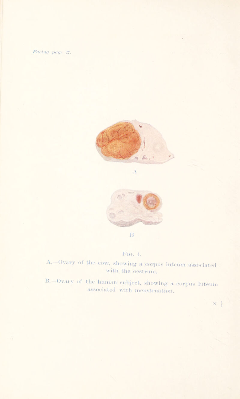 -Far/nr/ pa<n> 27. A. —Ovary B. Ovary B Big. 4. °i the cow’ showing a corpus luteum associated with the oestrum. of the human subject, showing a corpus luteum associated with menstruation. X 1