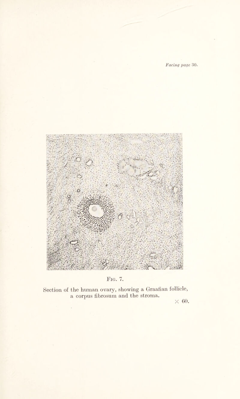 Fig. 7. Section of the human ovary, showing a Graafian follicle, a corpus fibrosum and the stroma. X 00.