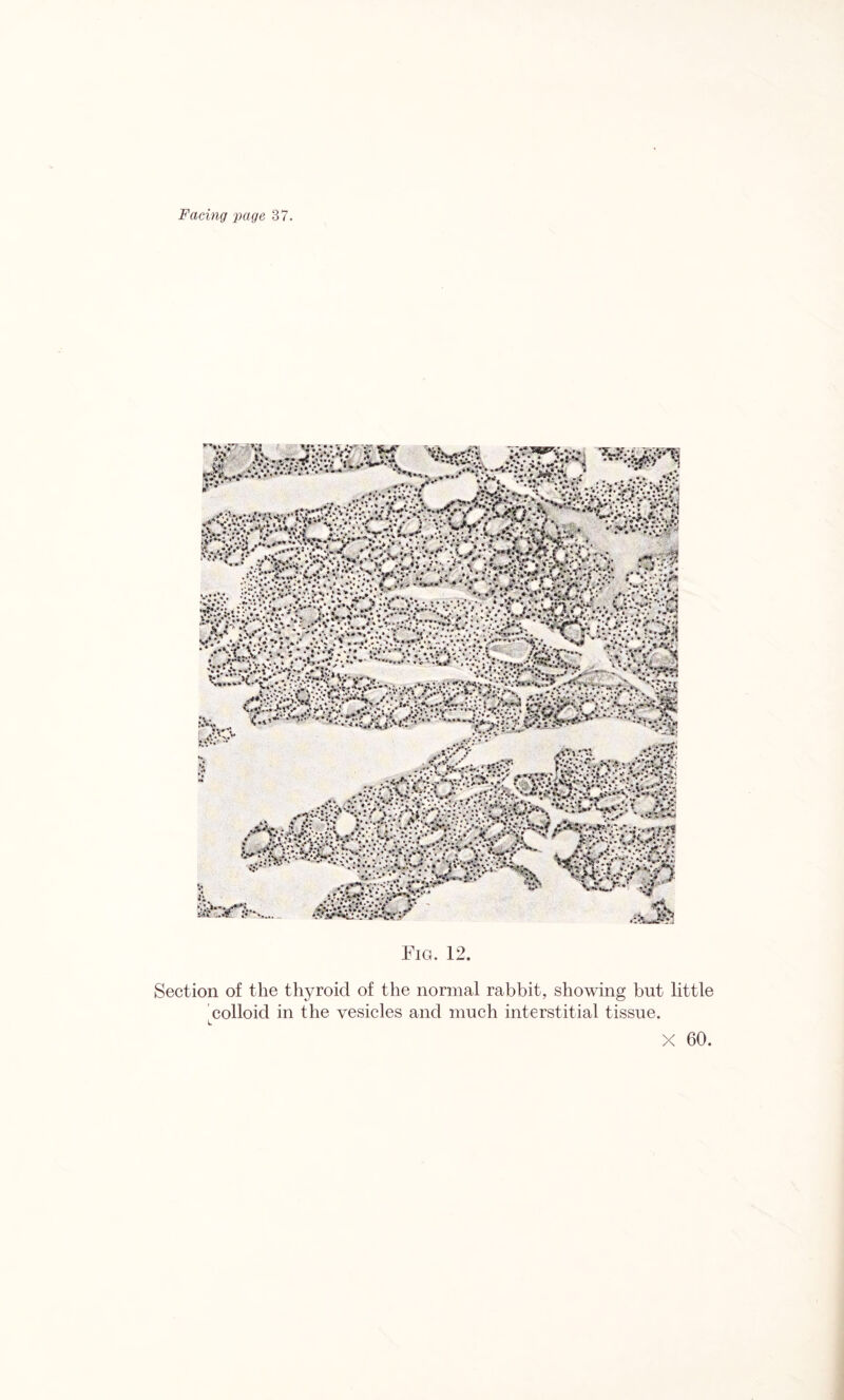 Fig. 12. Section of the thyroid of the normal rabbit, showing but little colloid in the vesicles and much interstitial tissue.