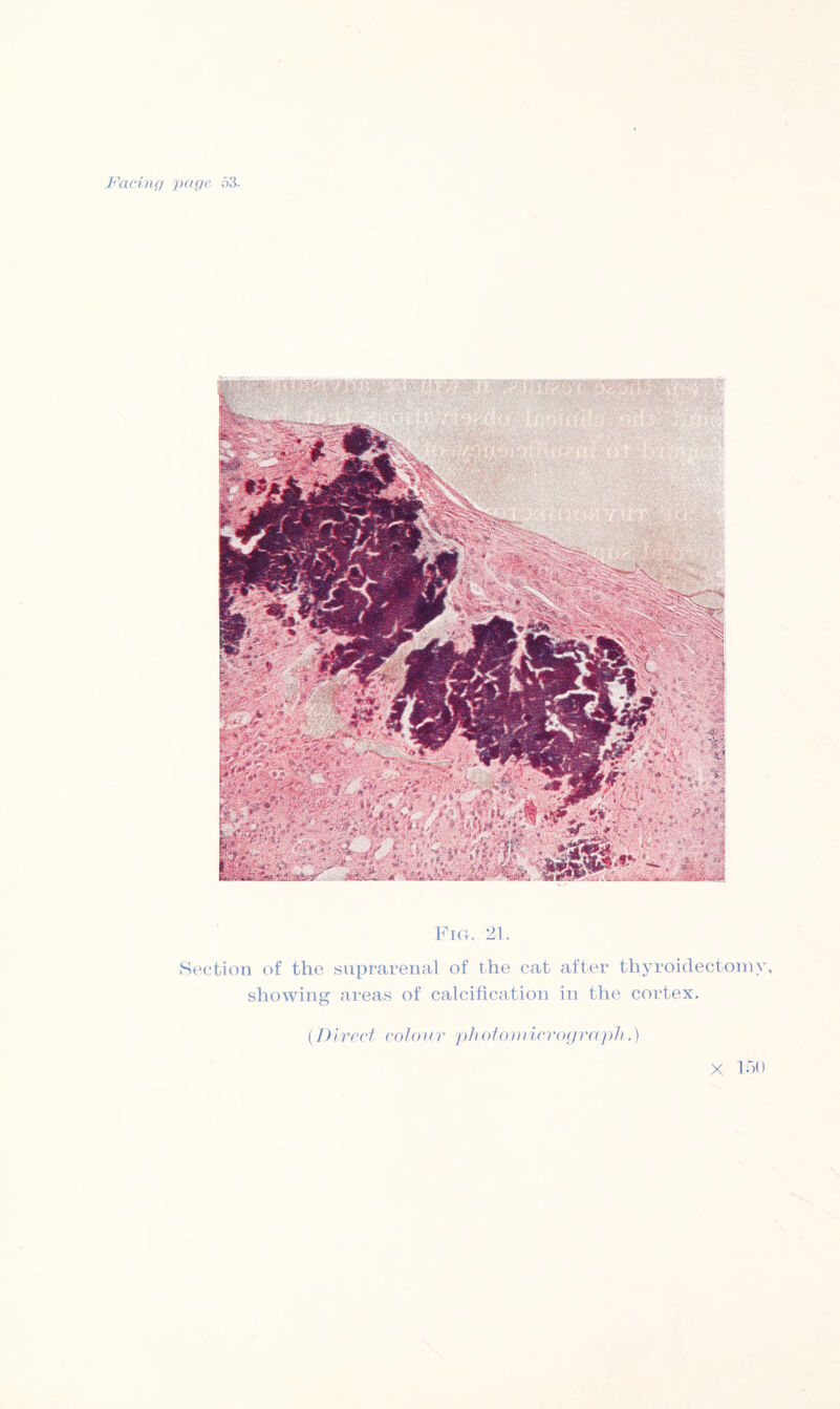 Fig. 21. Section of the suprarenal of the cat after thyroidectomy, showing areas of calcification in the cortex. (Direct colour photomicrograph.) X 150