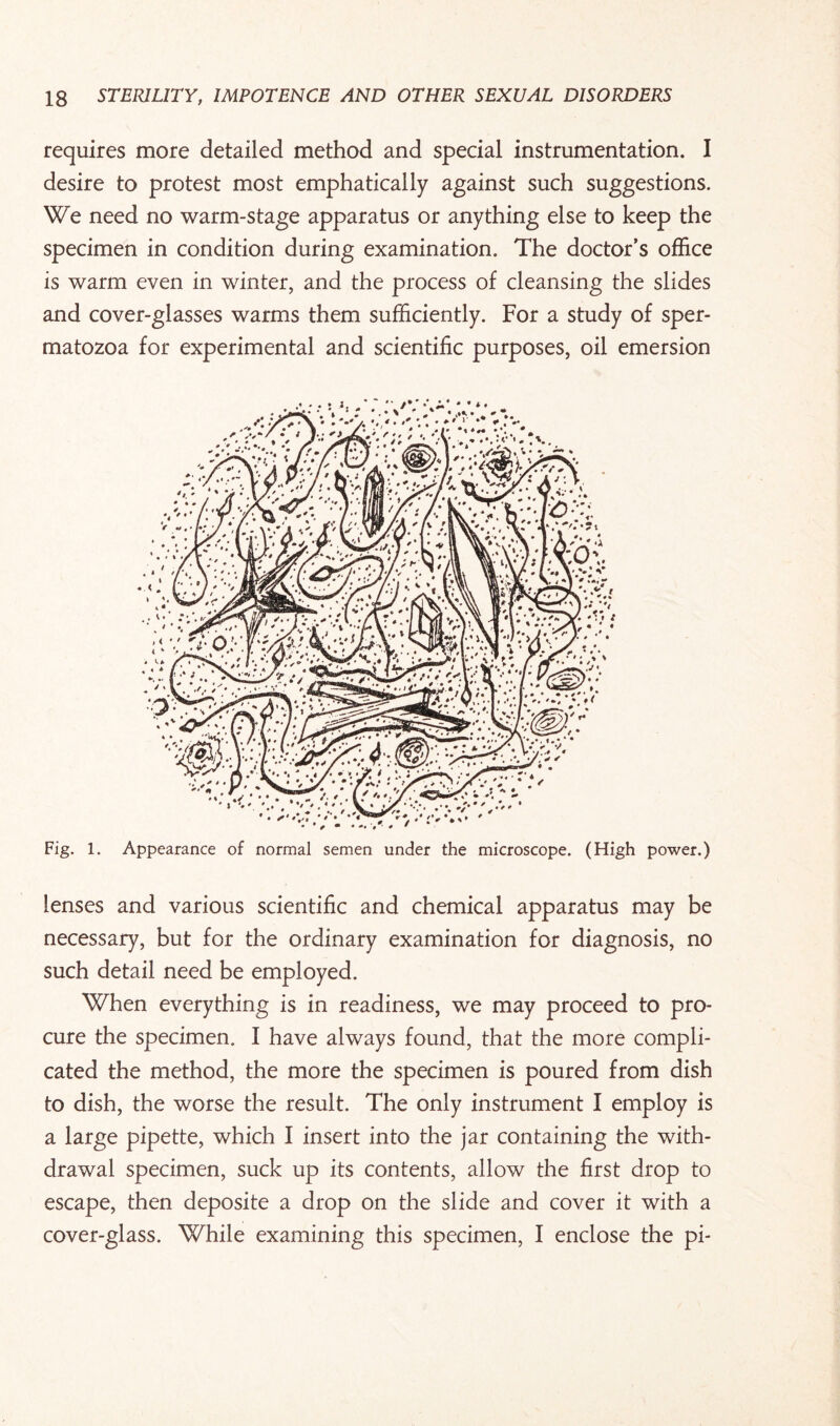 requires more detailed method and special instrumentation. I desire to protest most emphatically against such suggestions. We need no warm-stage apparatus or anything else to keep the specimen in condition during examination. The doctor’s office is warm even in winter, and the process of cleansing the slides and cover-glasses warms them sufficiently. For a study of sper¬ matozoa for experimental and scientific purposes, oil emersion Fig. 1. Appearance of normal semen under the microscope. (High power.) lenses and various scientific and chemical apparatus may be necessary, but for the ordinary examination for diagnosis, no such detail need be employed. When everything is in readiness, we may proceed to pro¬ cure the specimen. I have always found, that the more compli¬ cated the method, the more the specimen is poured from dish to dish, the worse the result. The only instrument I employ is a large pipette, which I insert into the jar containing the with¬ drawal specimen, suck up its contents, allow the first drop to escape, then deposite a drop on the slide and cover it with a cover-glass. While examining this specimen, I enclose the pi-
