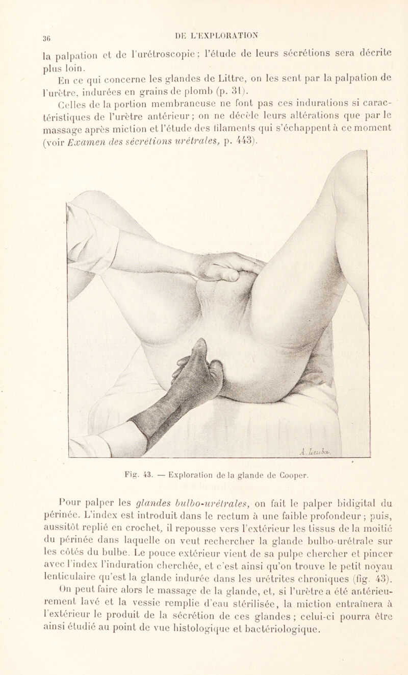 la palpation et de l’urétroscopie ; l’étude de leurs sécrétions sera décrite plus loin. En ce qui concerne les glandes de Littré, on les sent par la palpation de l’urètre, indurées en grains de plomb (p. 31). Celles de la portion membraneuse ne font pas ces indurations si carac¬ téristiques de l’urètre antérieur; on ne décèle leurs altérations que parle massage après miction et l’étude des lilaments qui s’échappent à ce moment (voir Examen des sécrétions urétrales, p. 443). Fig. 43. — Exploration delà glande de Gooper. Pour palper les glandes bnlbo-urétrales, on fait le palper bidigital du périnée. L’index est introduit dans le rectum à une faible profondeur ; puis, aussitôt replié en crochet, il repousse vers l’extérieur les tissus delà moitié du périnée dans laquelle on veut rechercher la glande bulbo-urétrale sur les côtés du bulbe. Le pouce extérieur vient de sa pulpe chercher et pincer avec 1 index l’induration cherchée, et c’est ainsi qu’on trouve le petit noyau lenticulaire qu’est la glande indurée dans les urétrites chroniques (flg. 43). Un peut faire alors le massage de la glande, et, si l’urètre a été antérieu¬ rement lavé et la vessie remplie d’eau stérilisée, la miction entraînera à 1 extérieur le produit de la sécrétion de ces glandes ; celui-ci pourra être ainsi étudié au point de vue histologique et bactériologique.