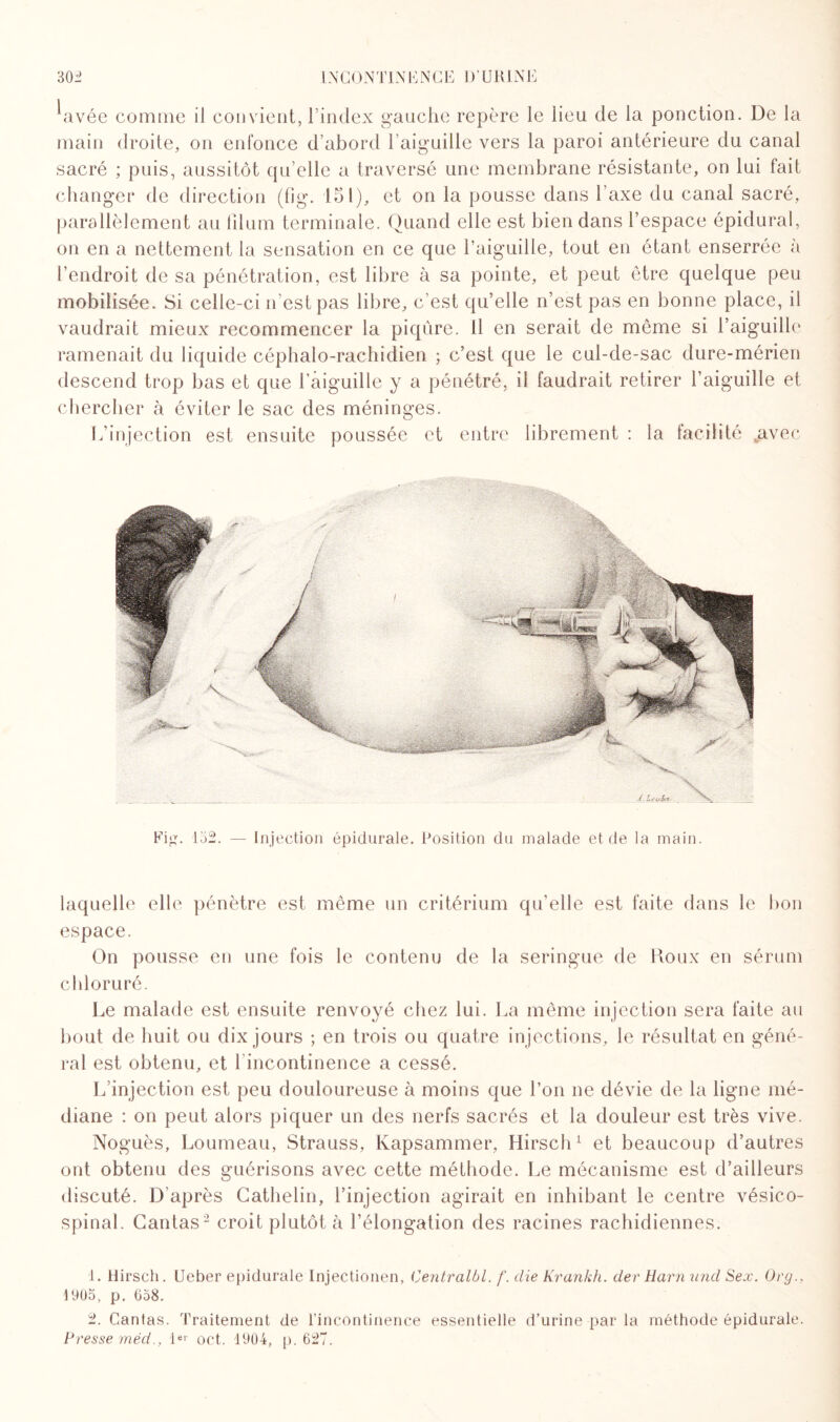 kavée comme il convient, l’index gauche repère le lieu de la ponction. De la main droite, on enfonce d’abord l’aiguille vers la paroi antérieure du canal sacré ; puis, aussitôt cpi’elle a traversé une membrane résistante, on lui fait changer de direction (fig. 151), et on la pousse dans l’axe du canal sacré, parallèlement au lilum terminale. Quand elle est bien dans l’espace épidural, on en a nettement la sensation en ce que l’aiguille, tout en étant enserrée à l’endroit de sa pénétration, est libre à sa pointe, et peut être quelque peu mobilisée. Si celle-ci n est pas libre, c’est qu’elle n’est pas en bonne place, il vaudrait mieux recommencer la piqûre. Il en serait de même si l’aiguille ramenait du liquide céphalo-rachidien ; c’est que le cul-de-sac dure-mérien descend trop bas et que l’aiguille y a pénétré, il faudrait retirer l’aiguille et chercher à éviter le sac des méninges. L’injection est ensuite poussée et entre librement : la facilité ^avec laquelle elle pénètre est même un critérium qu’elle est faite dans le bon espace. On pousse en une fois le contenu de la seringue de Roux en sérum chloruré. Le malade est ensuite renvoyé chez lui. La même injection sera faite au bout de huit ou dix jours ; en trois ou quatre injections, le résultat en géné¬ ral est obtenu, et 1 incontinence a cessé. L’injection est peu douloureuse à moins que l’on ne dévie de la ligne mé¬ diane : on peut alors piquer un des nerfs sacrés et la douleur est très vive. Noguès, Loumeau, Strauss, Kapsammer, Hirsch1 et beaucoup d’autres ont obtenu des guérisons avec cette méthode. Le mécanisme est d’ailleurs discuté. D’après Cathelin, l’injection agirait en inhibant le centre vésico- spinal. Gantas2 croit plutôt à l’élongation des racines rachidiennes. 1. Hirsch. IJeber epidurale Iniectionen, Centralbl. f. die Krankh. der Harn und Sex. Ora., 1905, p. 658. 2. Cantas. Traitement de l’incontinence essentielle d’urine par la méthode épidurale. Presse méd., 1er oct. 1904, p. 627.