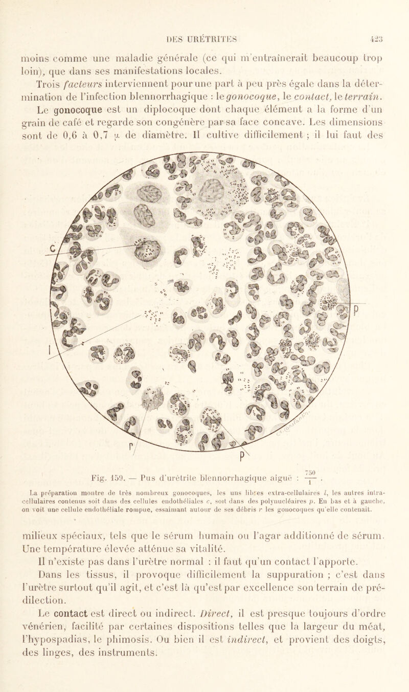 moins comme une maladie générale (ce qui m'entraînerait beaucoup trop loin), que dans ses manifestations locales. Trois fadeurs interviennent pour une part à peu près égale dans la déter¬ mination de l’infection blennorrhagique : le gonocoque, le contact, le terrain. Le gonocoque est un diplocoque dont chaque élément a la forme d’un grain de café et regarde son congénère par sa face concave. Les dimensions sont de 0,6 à 0,7 u. de diamètre. Il cultive difficilement ; il lui faut des Fig. 159. — Pas d'urétrite blennorrhagique aiguë : —- . La préparation montre de très nombreux gonocoques, les uns libres extra-cellulaires Z, les autres intra¬ cellulaires contenus soit dans des cellules endothéliales c, soit dans des polynucléaires p. En bas et à gauche, un voit une cellule endothéliale rompue, essaimant autour de ses débris r les gonocoques qu’elle contenait. milieux spéciaux, tels que le sérum humain ou l’agar additionné de sérum. Une température élevée atténue sa vitalité. Il n’existe pas dans l’urètre normal : il faut qu’un contact l’apporte. Dans les tissus, il provoque difficilement la suppuration ; c’est dans l’urètre surtout qu’il agit, et c’est là qu’est par excellence son terrain de pré¬ dilection. Le contact est direct ou indirect. Direct, il est presque toujours d’ordre vénérien, facilité par certaines dispositions telles que la largeur du méat, Lhypospadias, le phimosis. Ou bien il est indirect, et provient des doigts, des linges, des instruments.